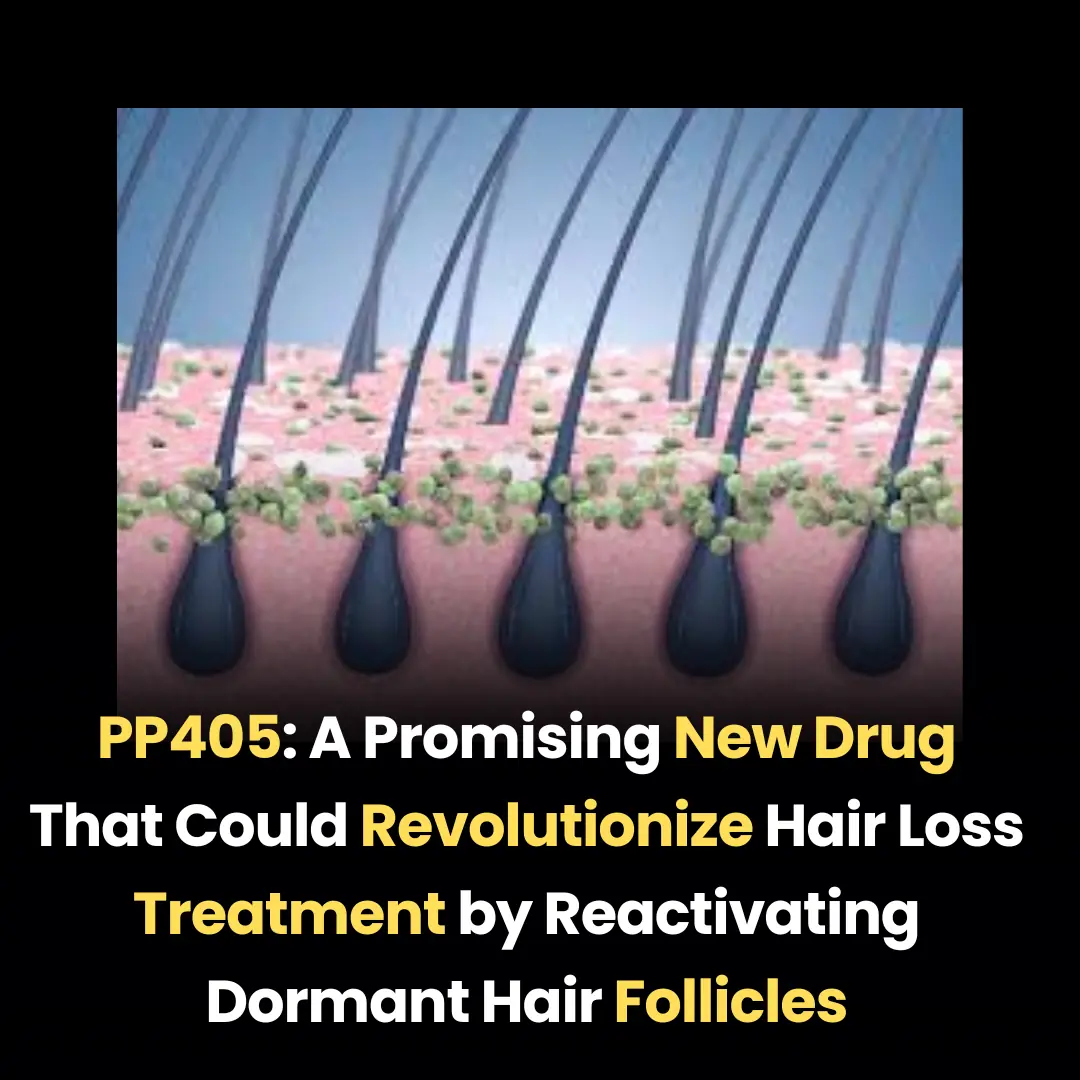 PP405: A Promising New Drug That Could Revolutionize Hair Loss Treatment by Reactivating Dormant Hair Follicles