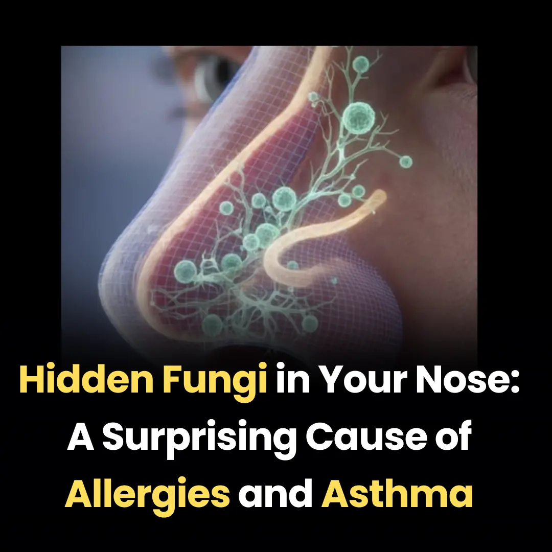 Hidden Fungi in Your Nose: A Surprising Cause of Allergies and Asthma