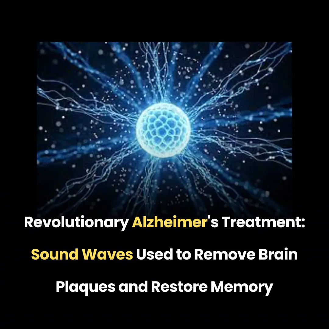 Revolutionary Alzheimer's Treatment: Sound Waves Used to Remove Brain Plaques and Restore Memory