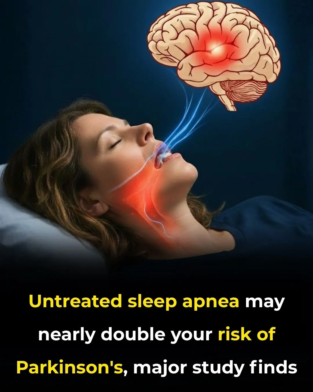 Untreated sleep apnea may nearly double your risk of Parkinson’s, major study finds