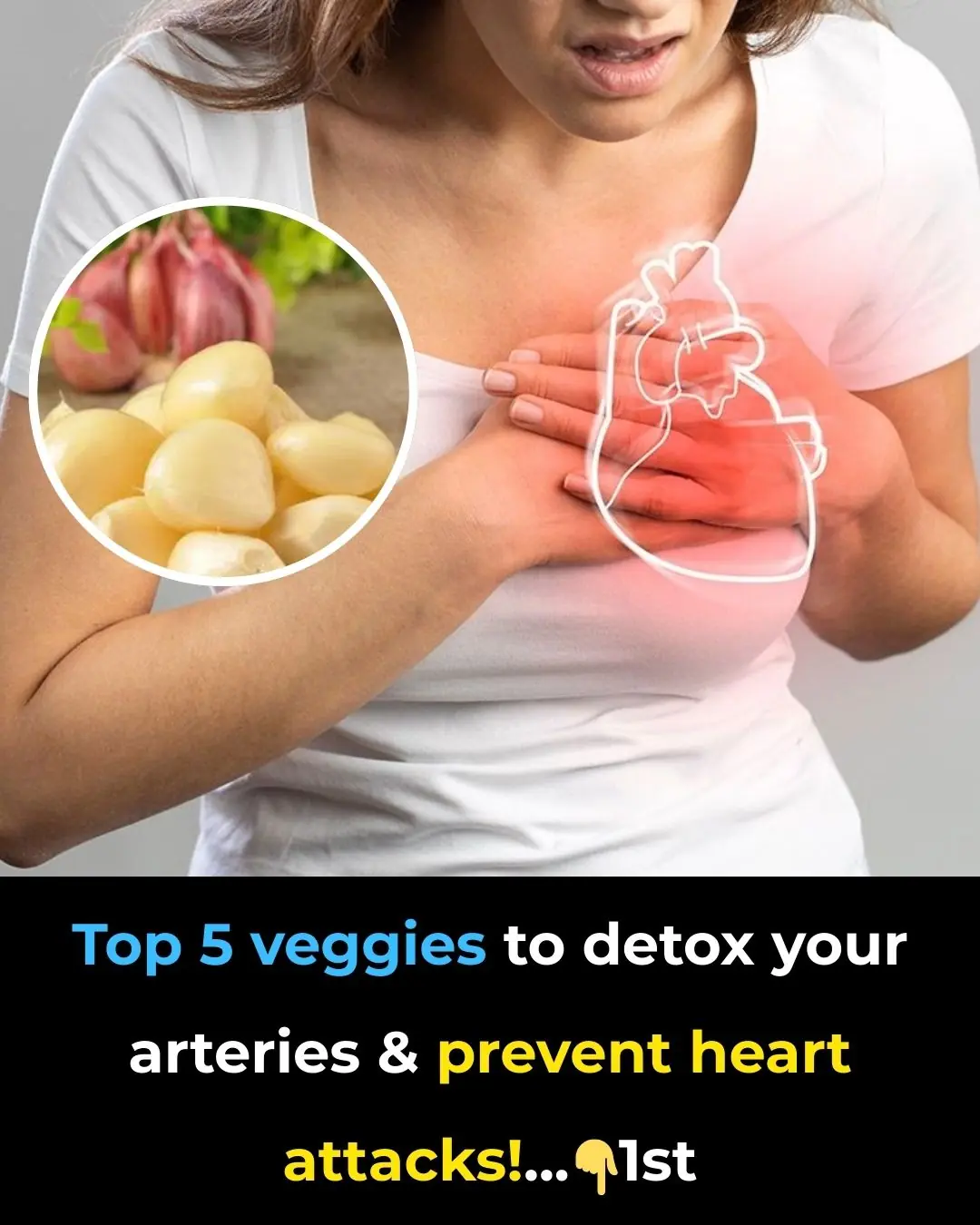 Top 5 Veggies to Detox Your Arteries and Prevent Heart Attacks!
