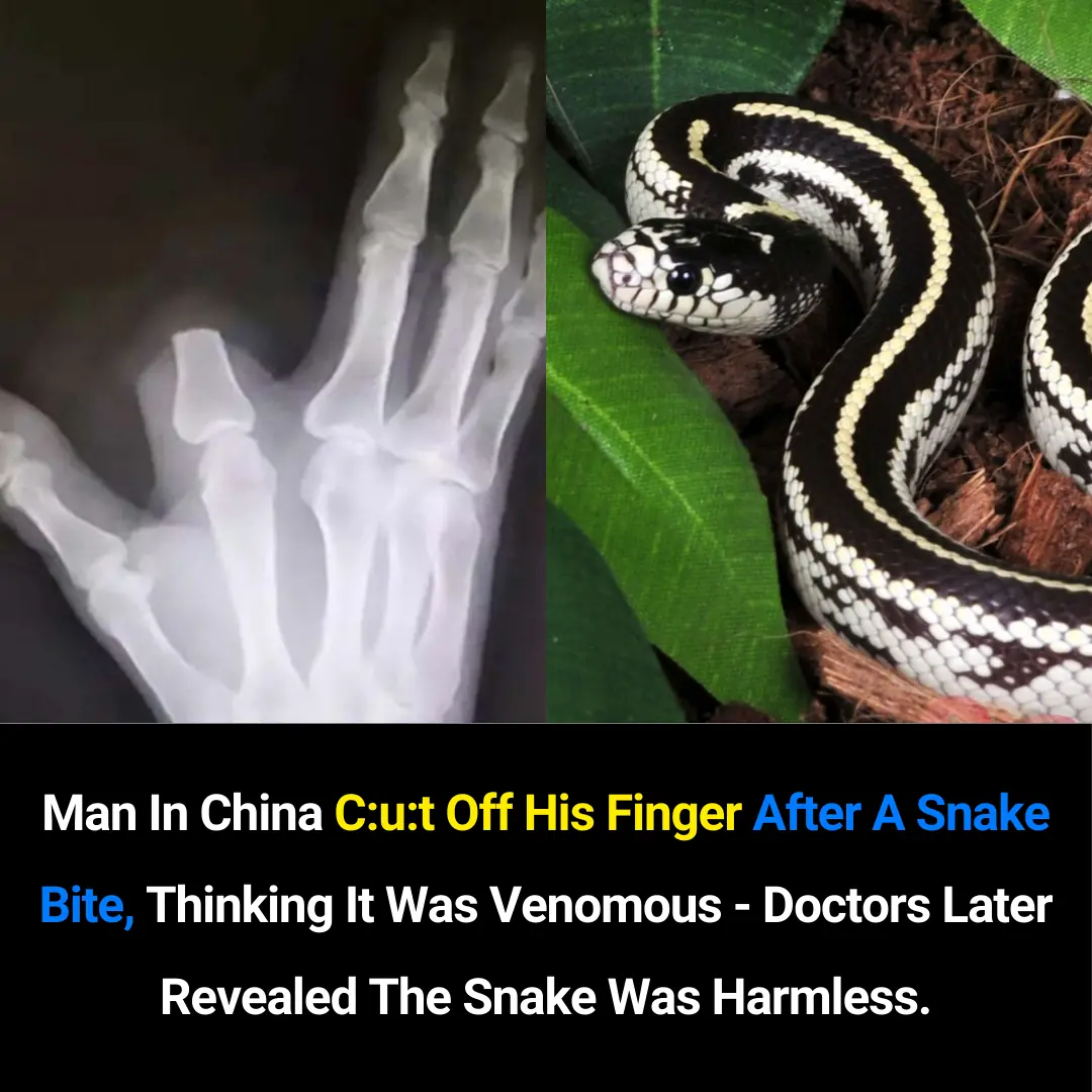 ✅ International Medical Recommendations for Treating Snakebites