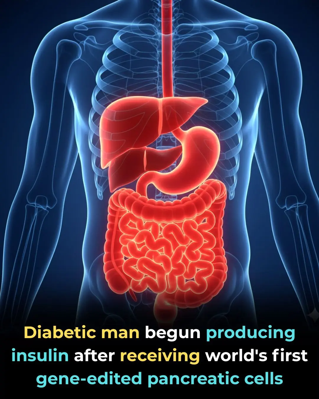 Groundbreaking Gene-Edited Cell Therapy Shows Promise for Type 1 Diabetes Cure