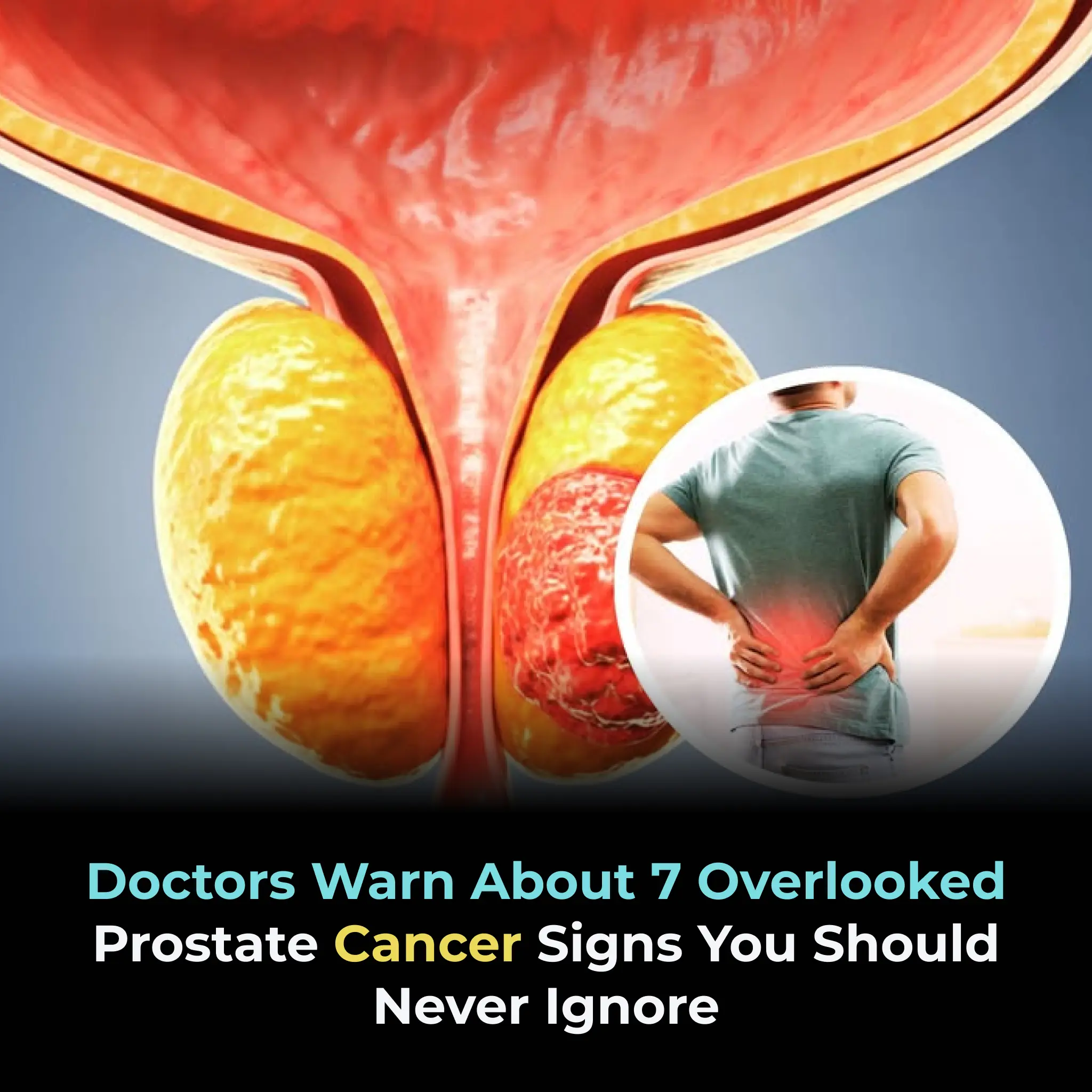Doctors warn about 7 overlooked prostate cancer signs you should never ignore