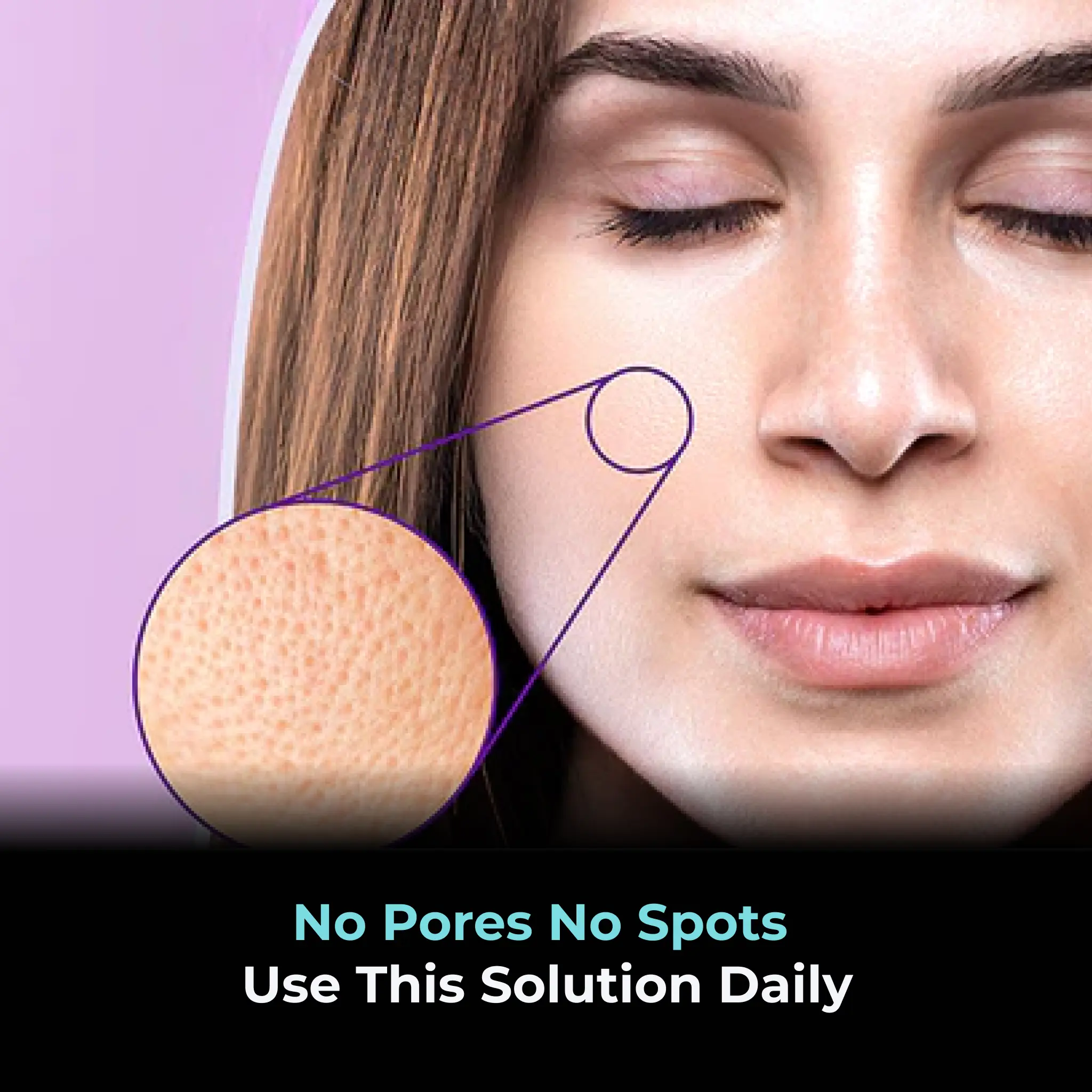 No Pores No Spots  Use this Solution daily