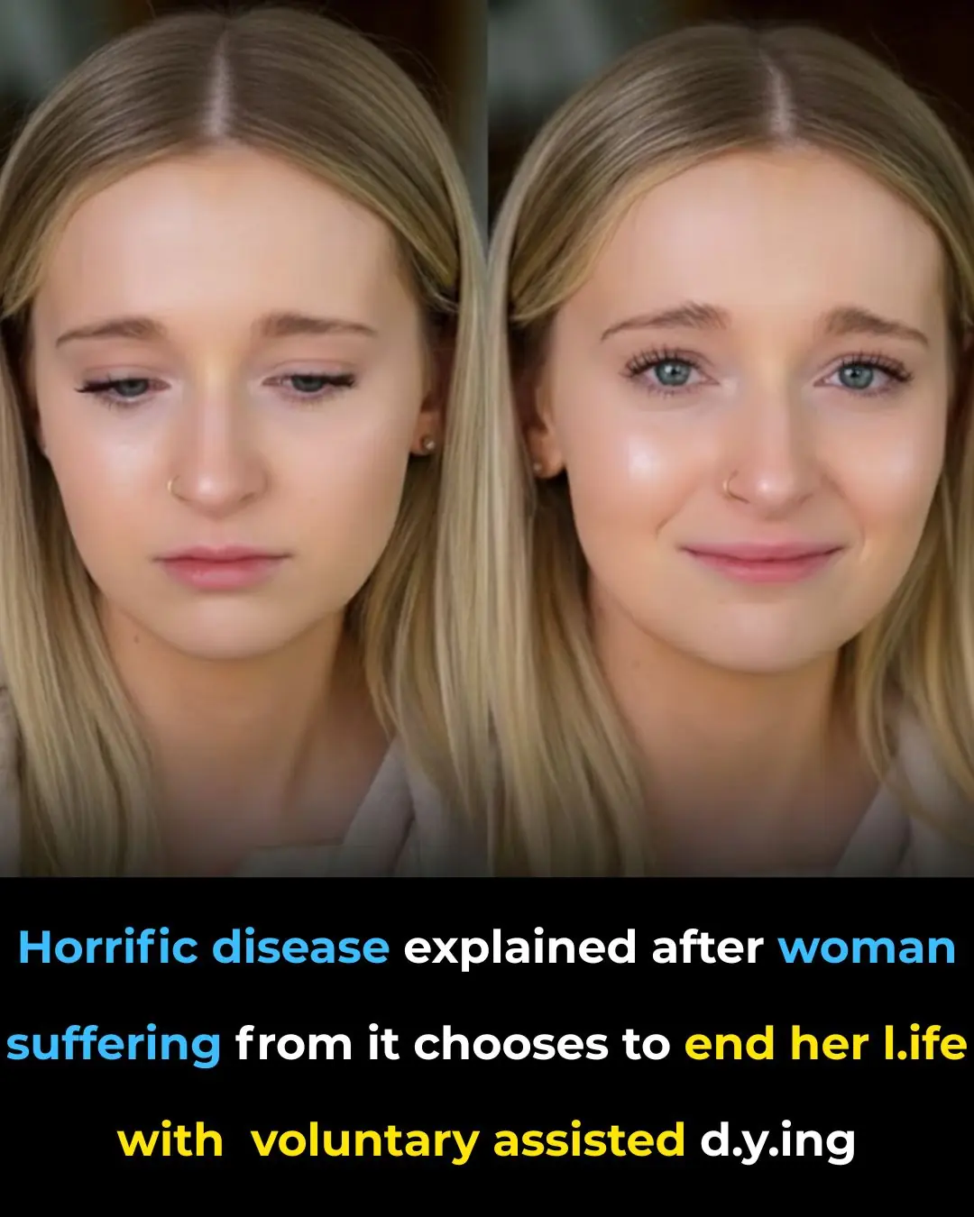 Living With a Rare Condition, a 25-Year-Old Faces One of Life’s Hardest Decisions