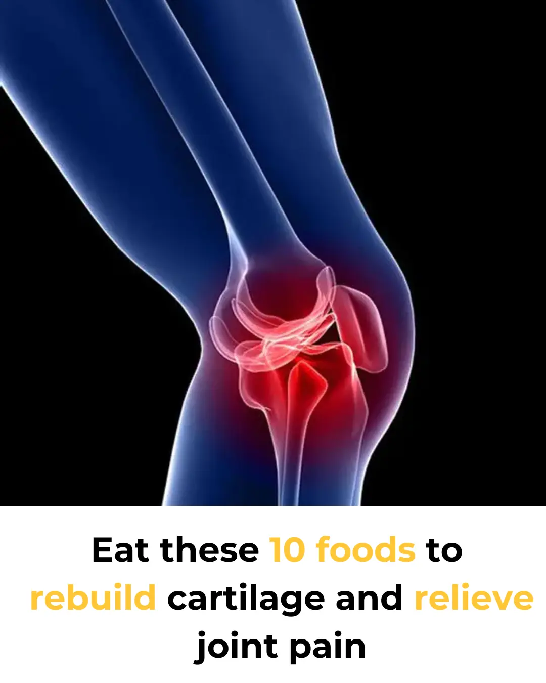 Top 10 Foods to Heal Knee Pain and Rebuild Cartilage Naturally