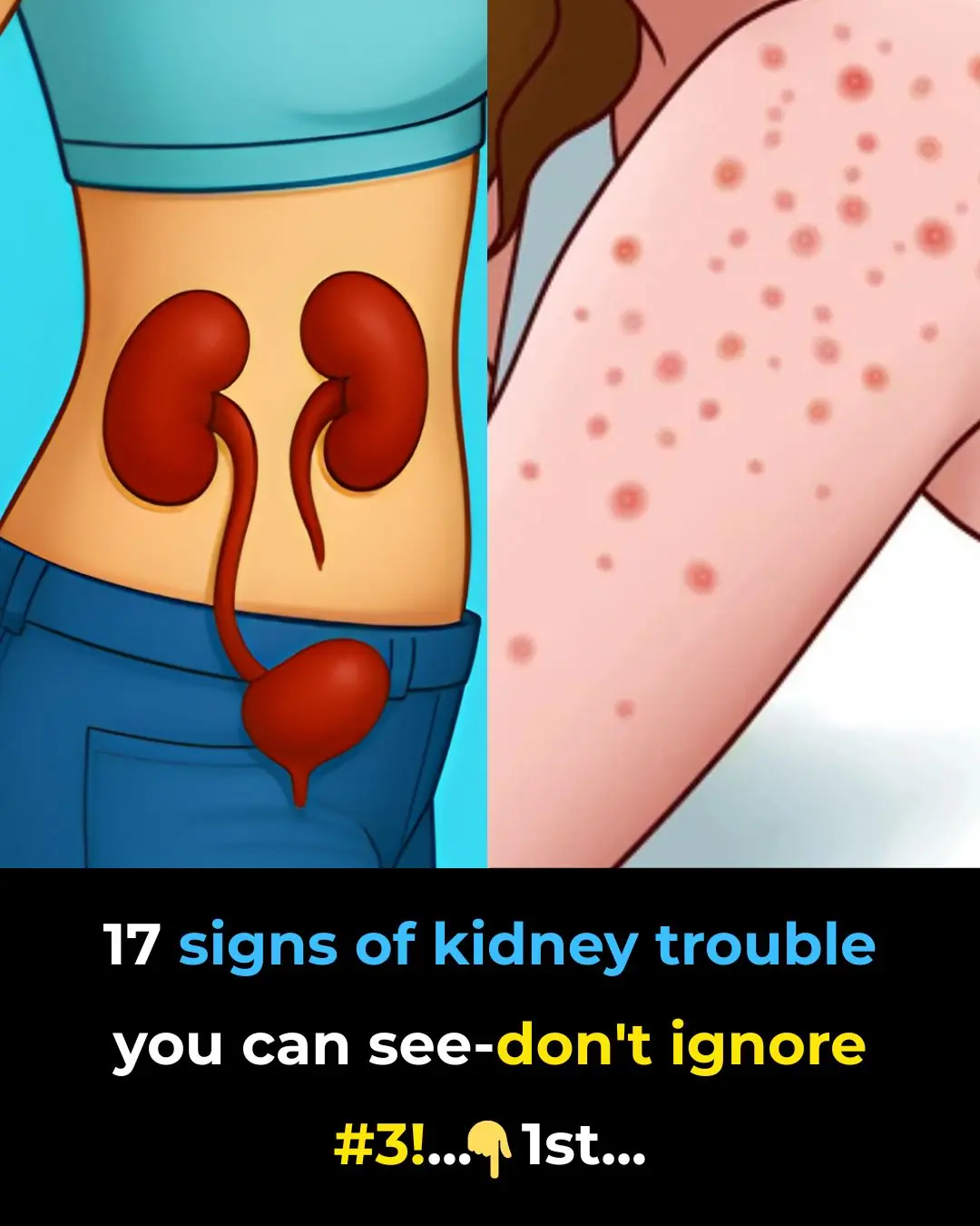 17 signs of kidney trouble you can see—don’t ignore #3!