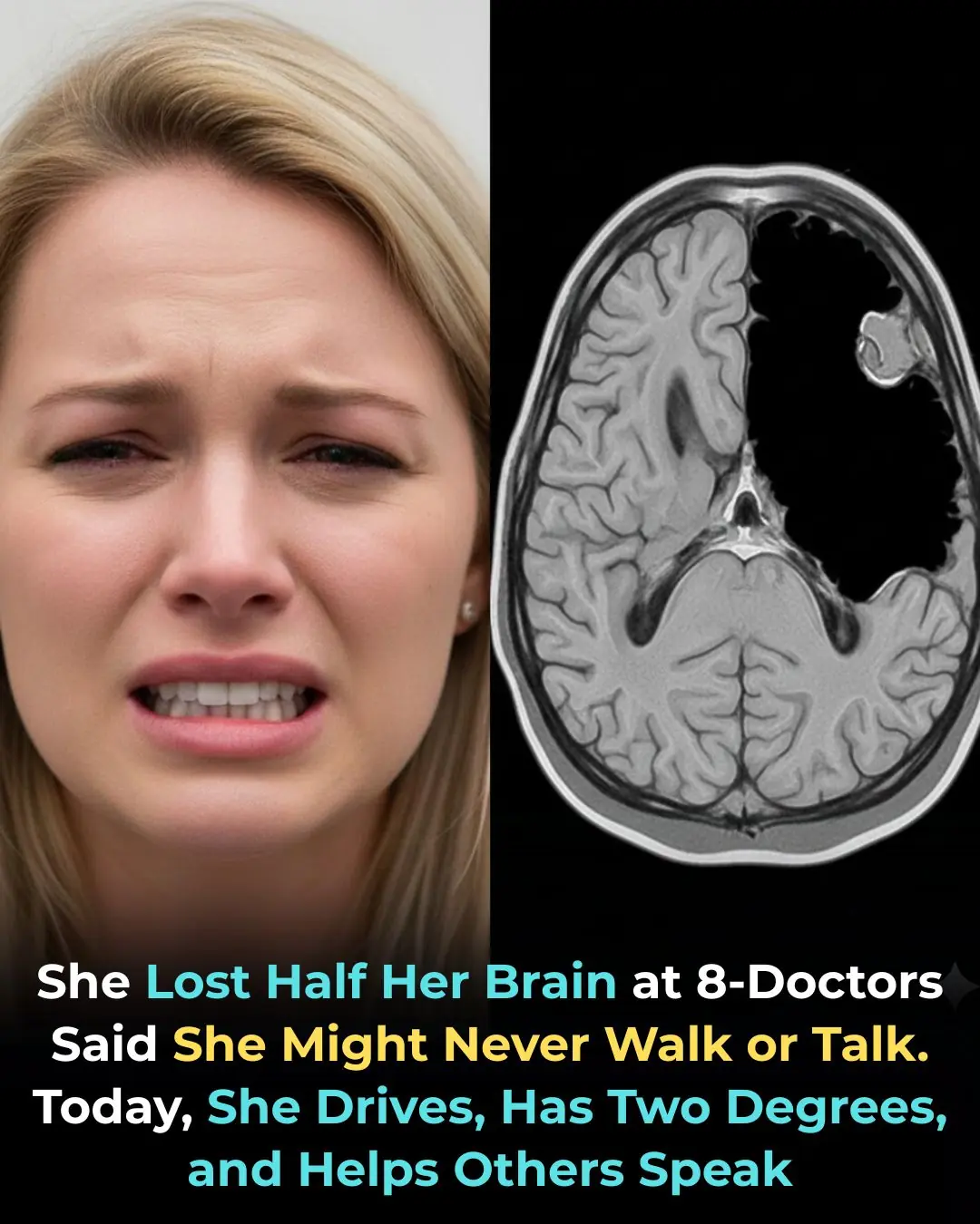 She Lost Half Her Brain — But Rebuilt an Entire Life