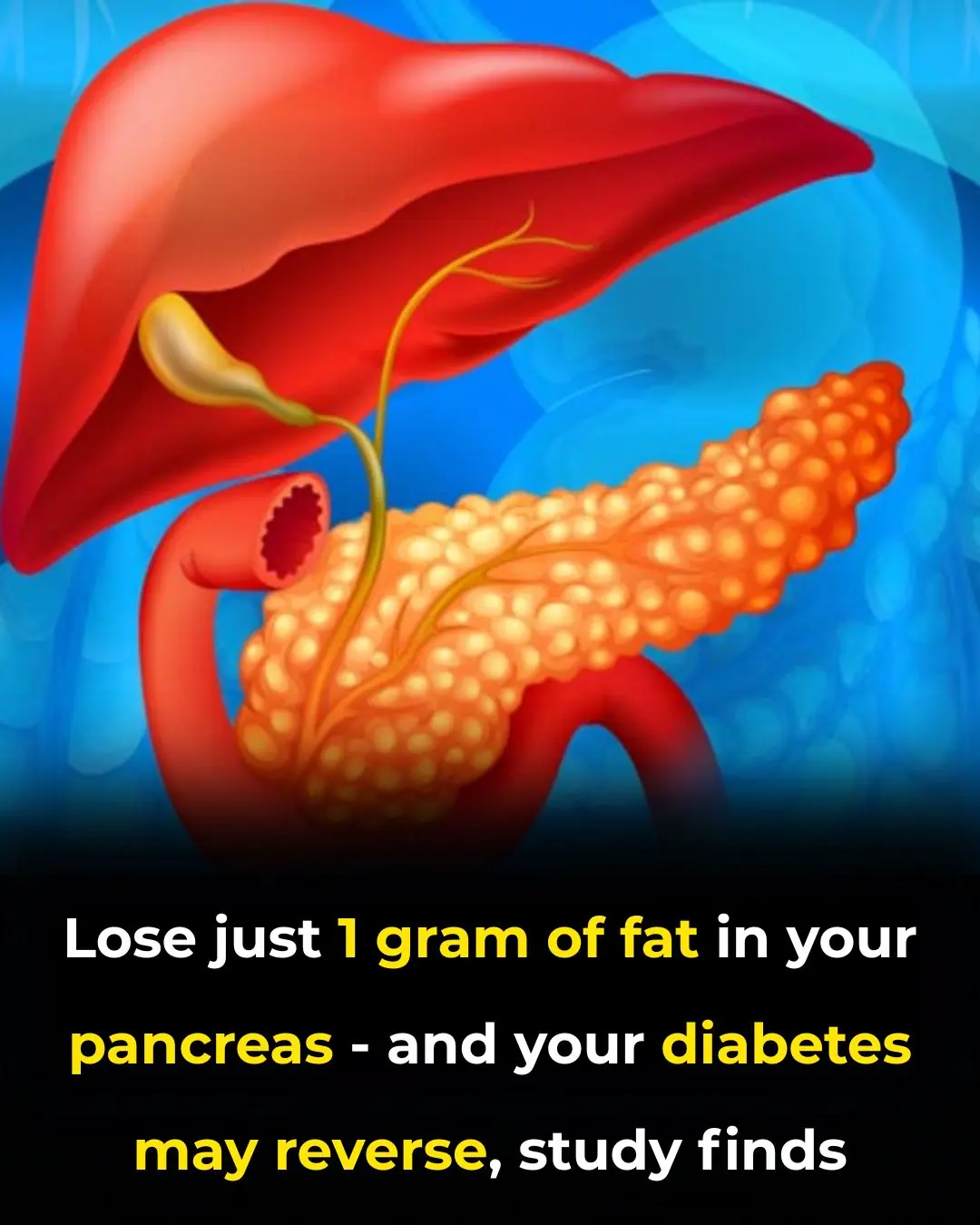Losing Just 1 Gram of Fat In The Pancreas Will Have THIS Effect On Your Body