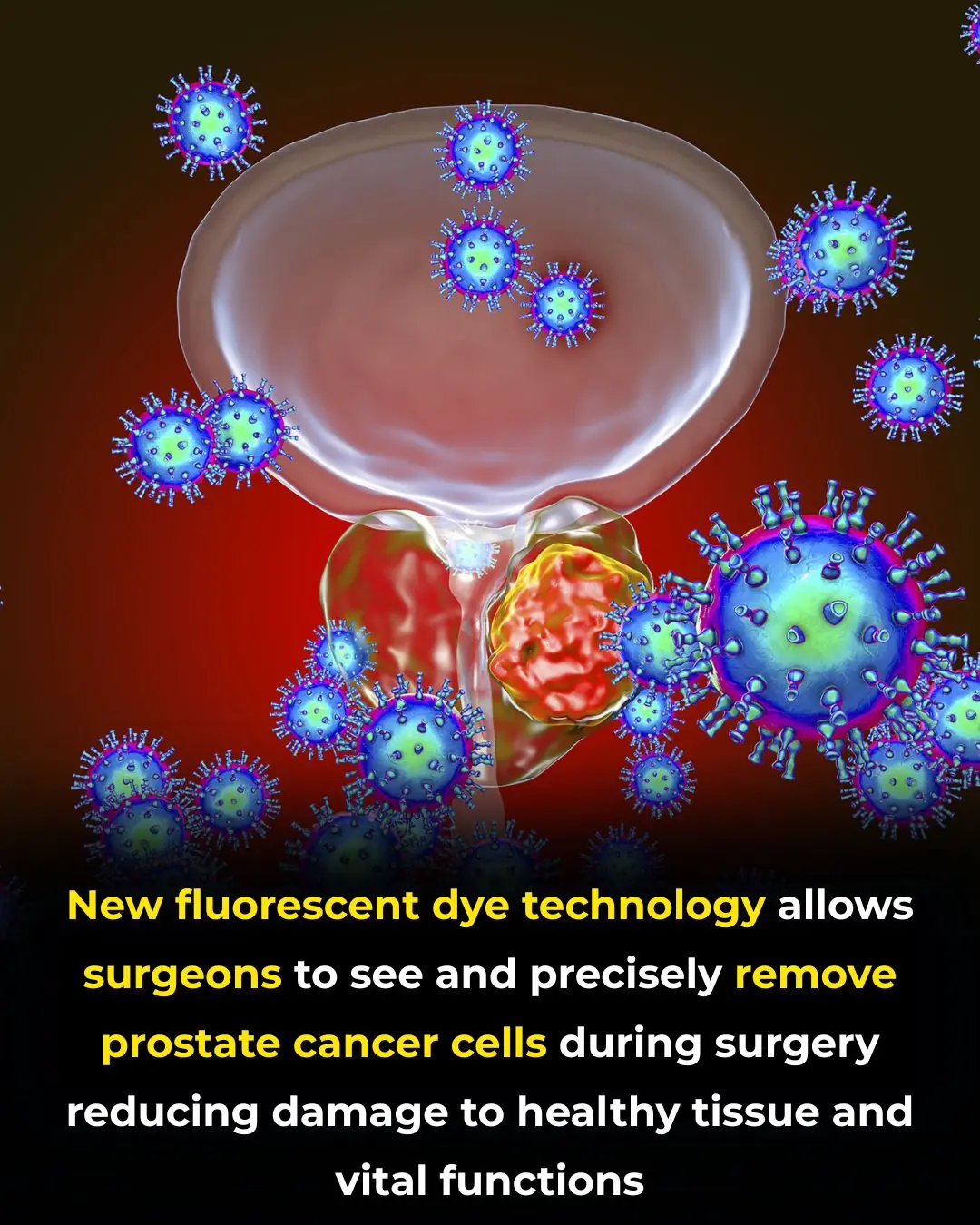 A Fluorescent Breakthrough: New Dye Helps Surgeons Precisely Target Prostate Cancer