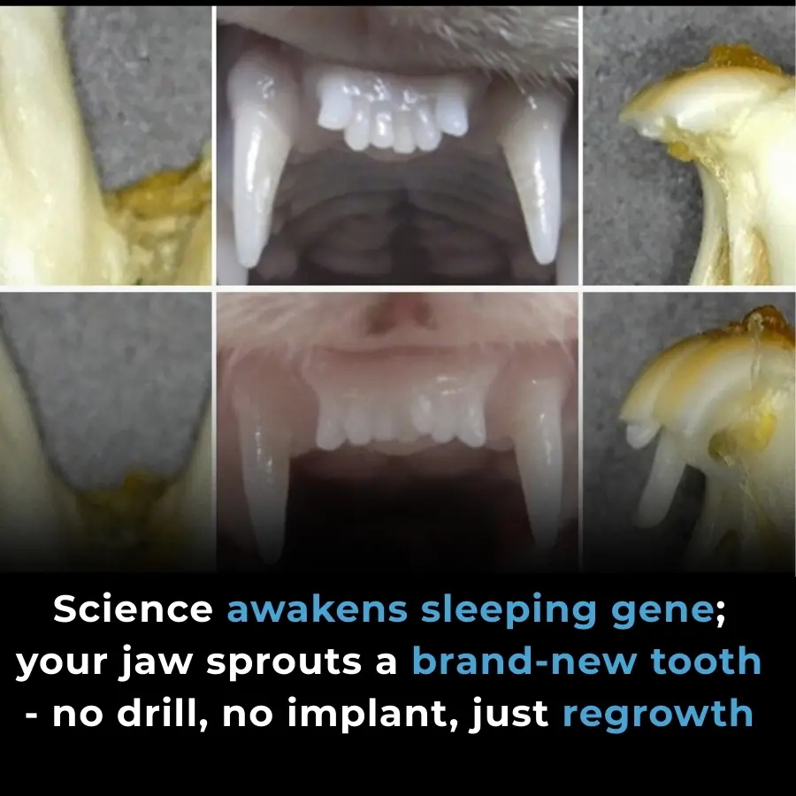 Japanese Scientists Launch Human Trials for TRG-035, a Drug That Could Regrow Lost Teeth Naturally