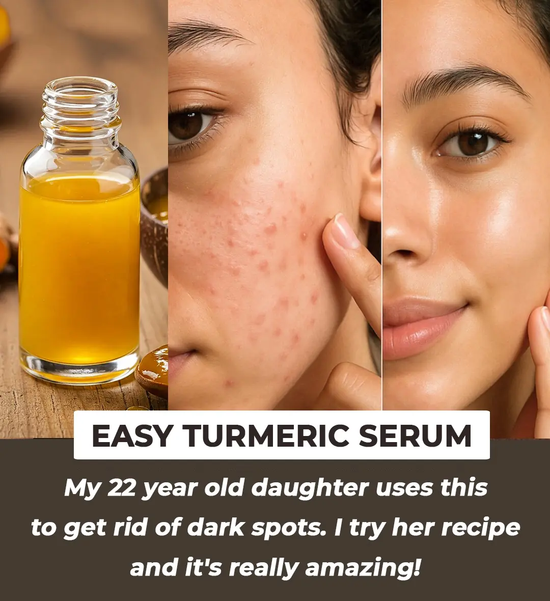 Unlock Glowing Skin with Homemade Turmeric Serum & Cream for Dark Spots and Hyperpigmentation