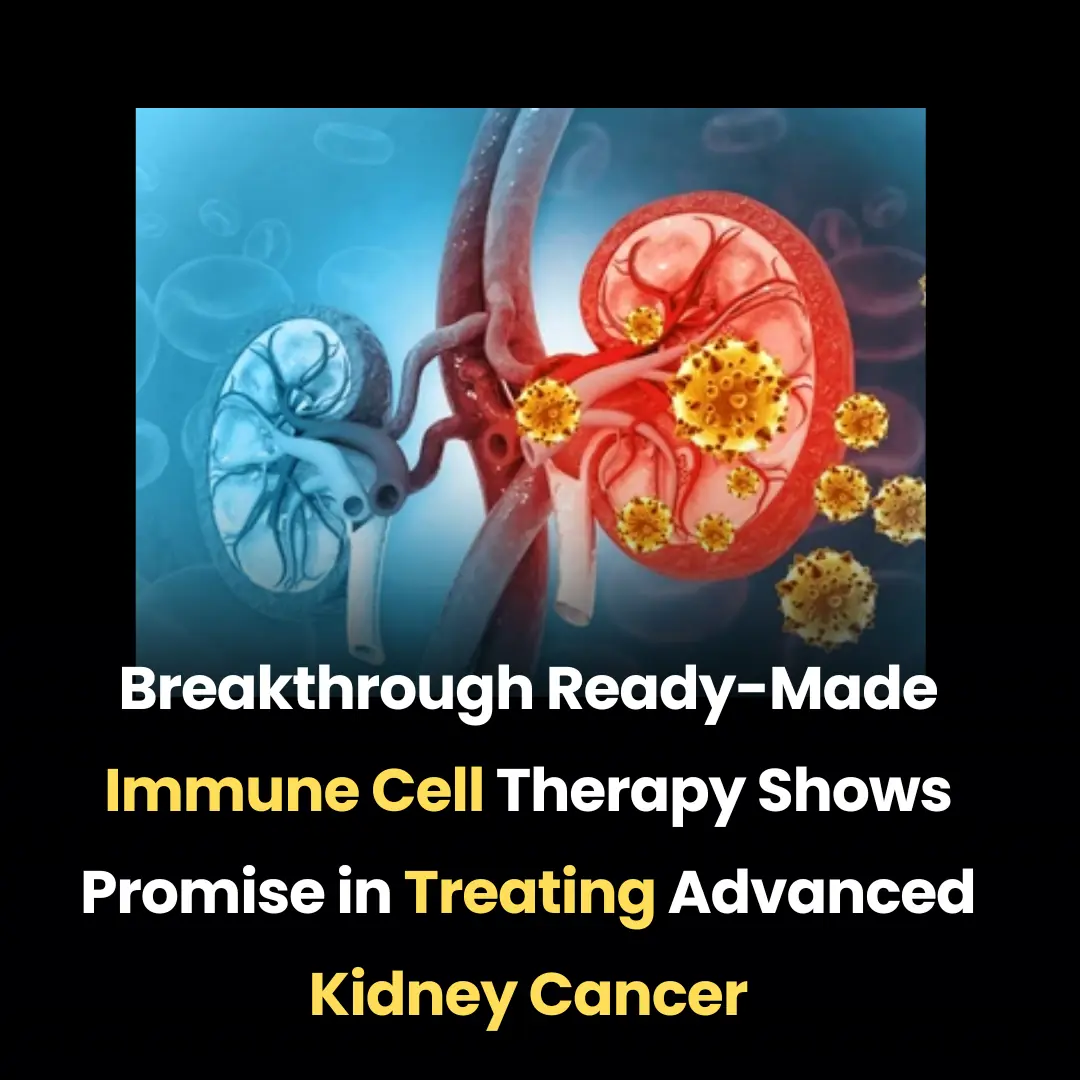 Breakthrough Ready-Made Immune Cell Therapy Shows Promise in Treating Advanced Kidney Cancer