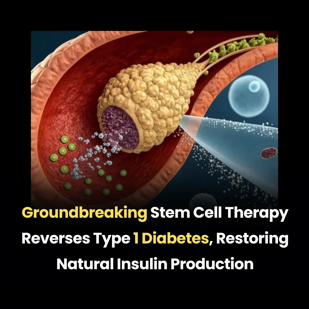 Groundbreaking Stem Cell Therapy Reverses Type 1 Diabetes, Restoring Natural Insulin Production