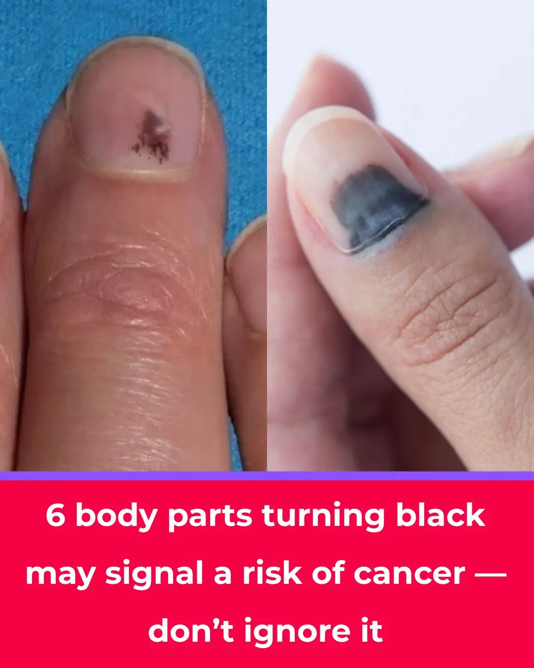 Health Alert: 6 Black-Colored Body Changes That May Signal a Serious Disease — Don’t Ignore Them