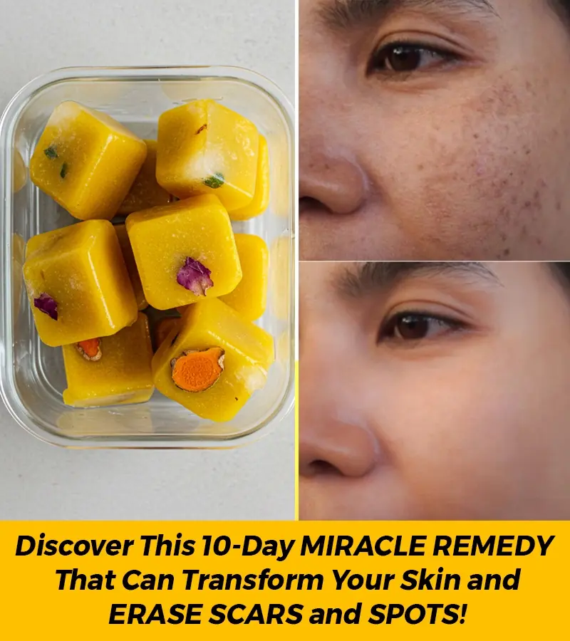 How to Make Turmeric Ice Cubes for Clear Skin and Dark Spot Reduction
