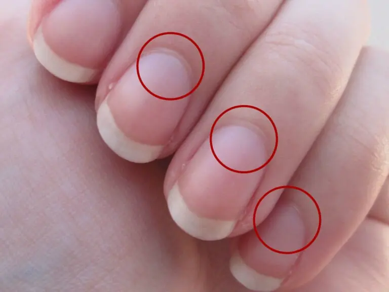 Your fingernails are trying to tell you something — don’t ignore these signs