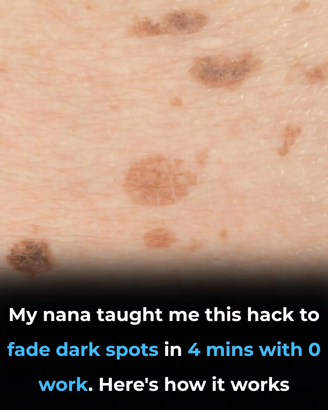 My nana taught me this hack to fade dark spots in 4 mins with 0 work. Here’s how it works