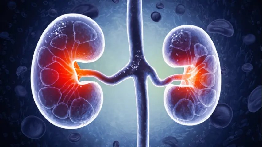 Signs of kidney failure that if ignored may require lifelong dialysis
