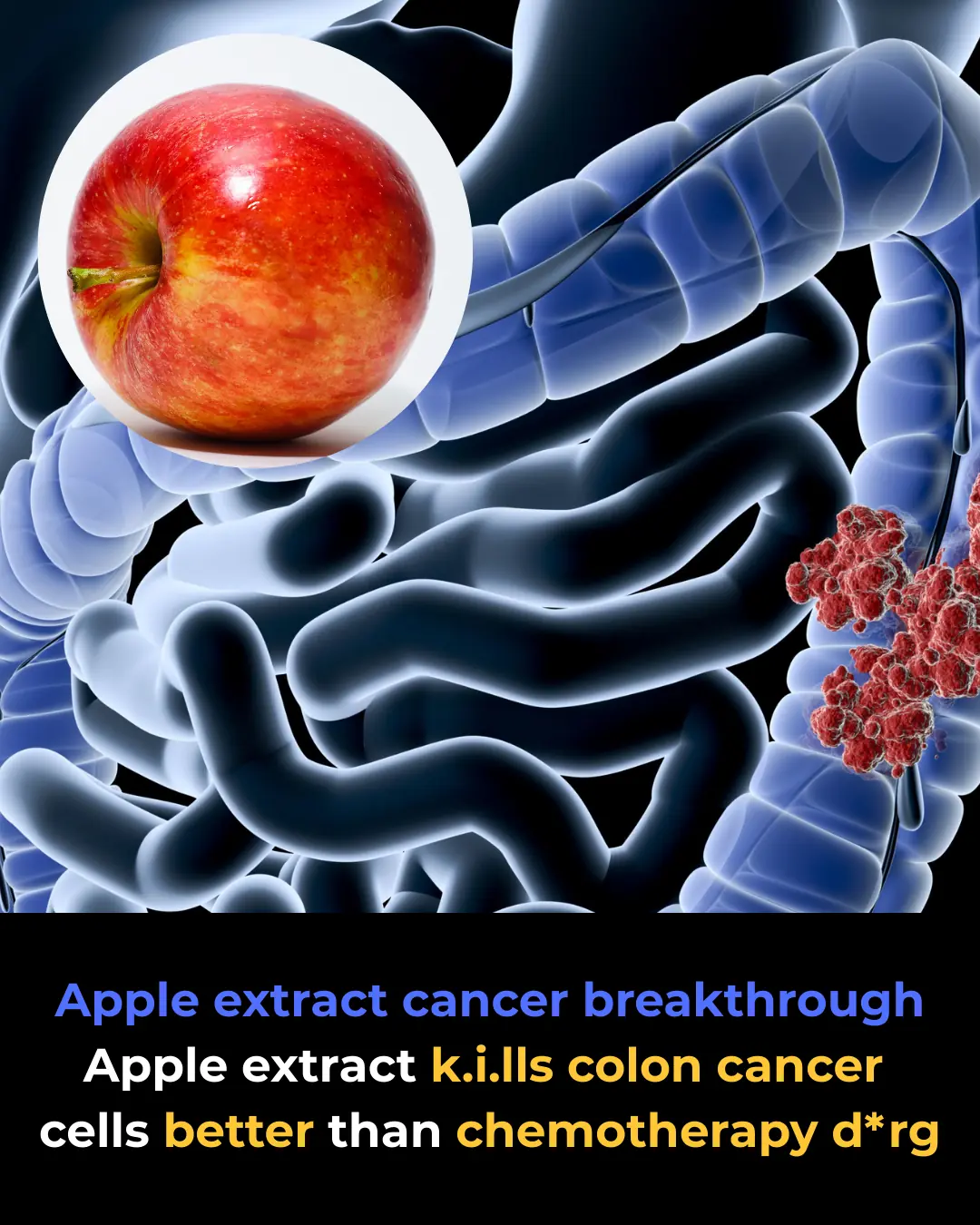 Apple Extract: A Natural Alternative to Chemotherapy for Treating Colon Cancer