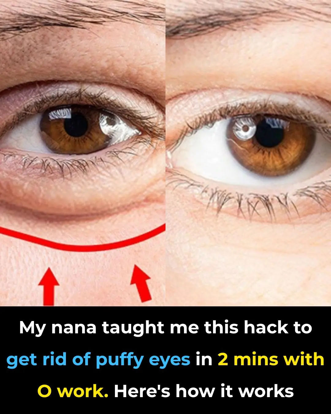 The 2-Minute Potato Trick My Nana Swore By for Puffy Eyes