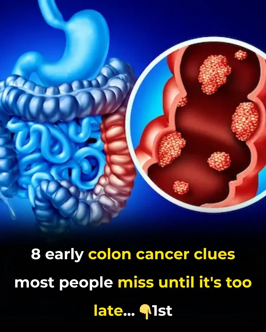 8 warning signs of colon cancer you should never ignore