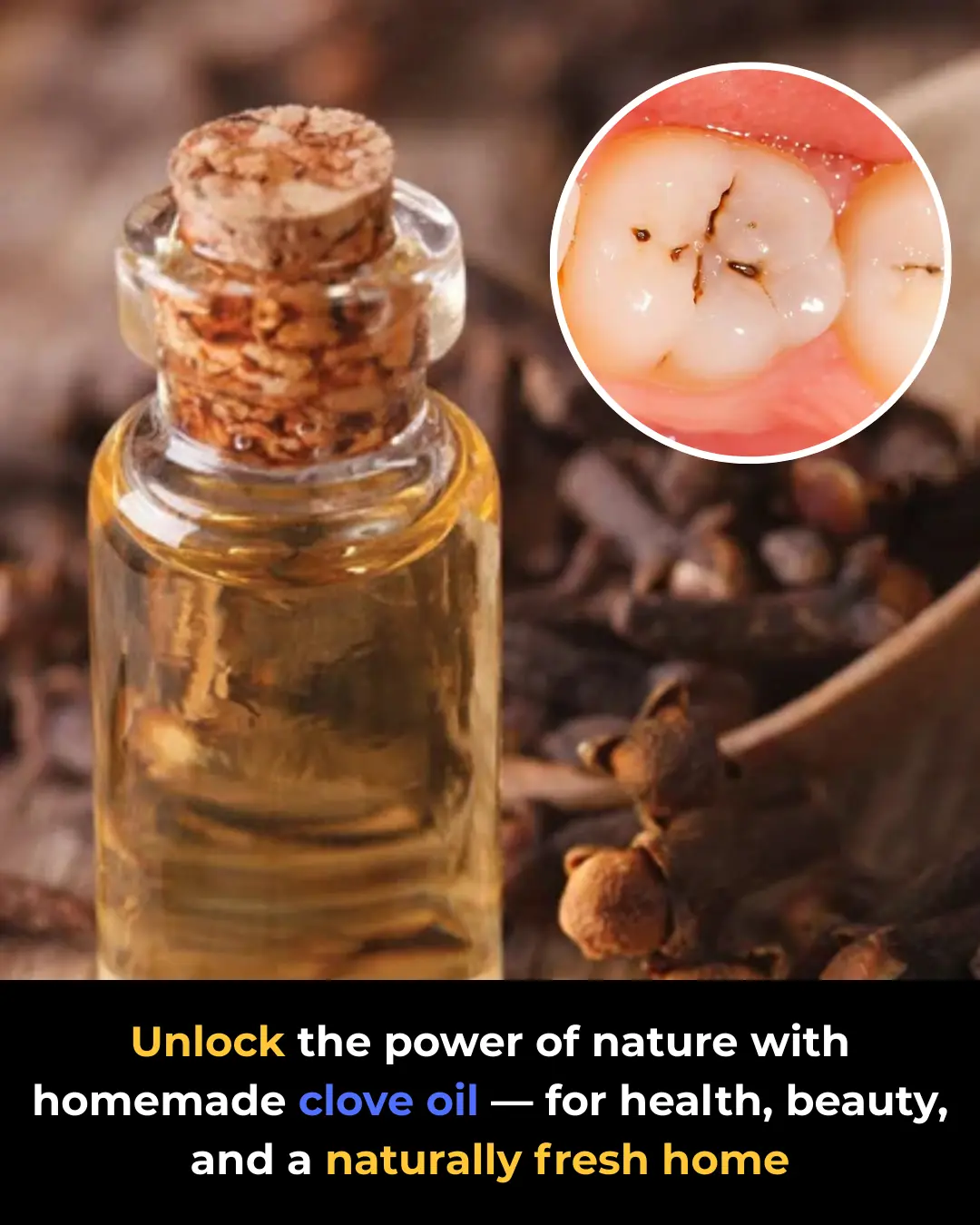 How to Make Homemade Clove Oil and Unlock Its Incredible Benefits