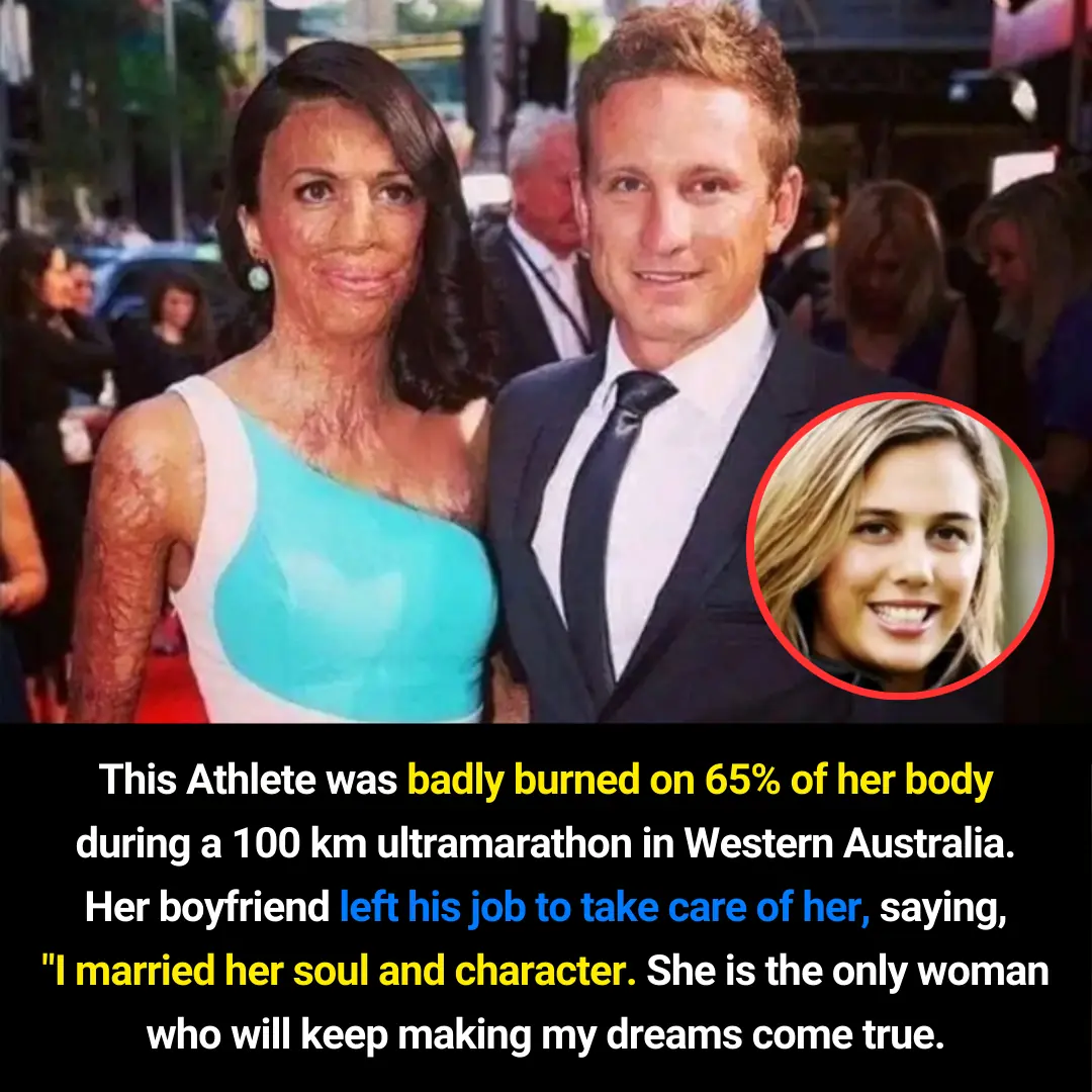 Turia Pitt: From Tragedy to Global Inspiration — A Story of Courage, Recovery, and Unbreakable Love