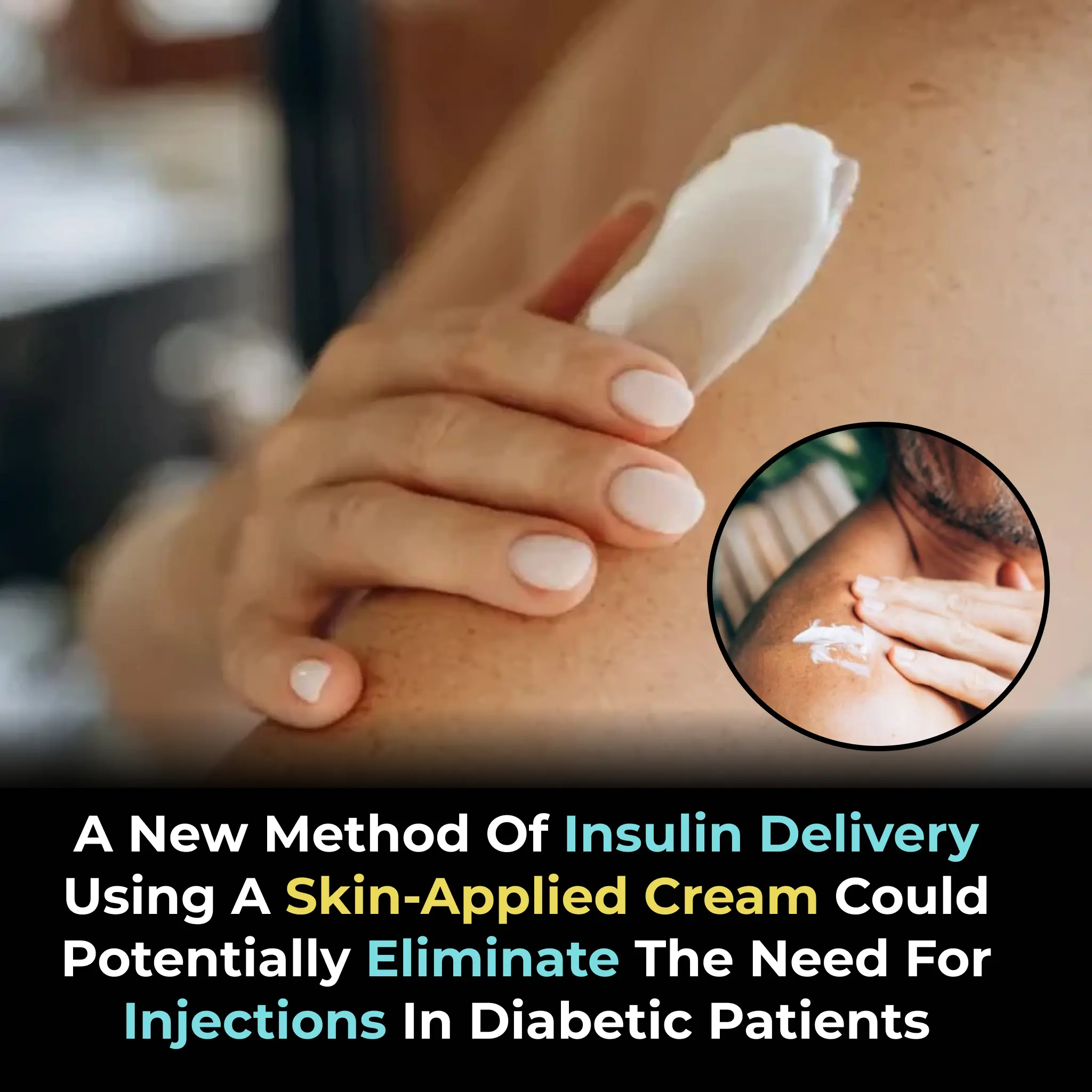 Breakthrough Polymer Cream Could One Day Replace Insulin Injections, Study Suggests