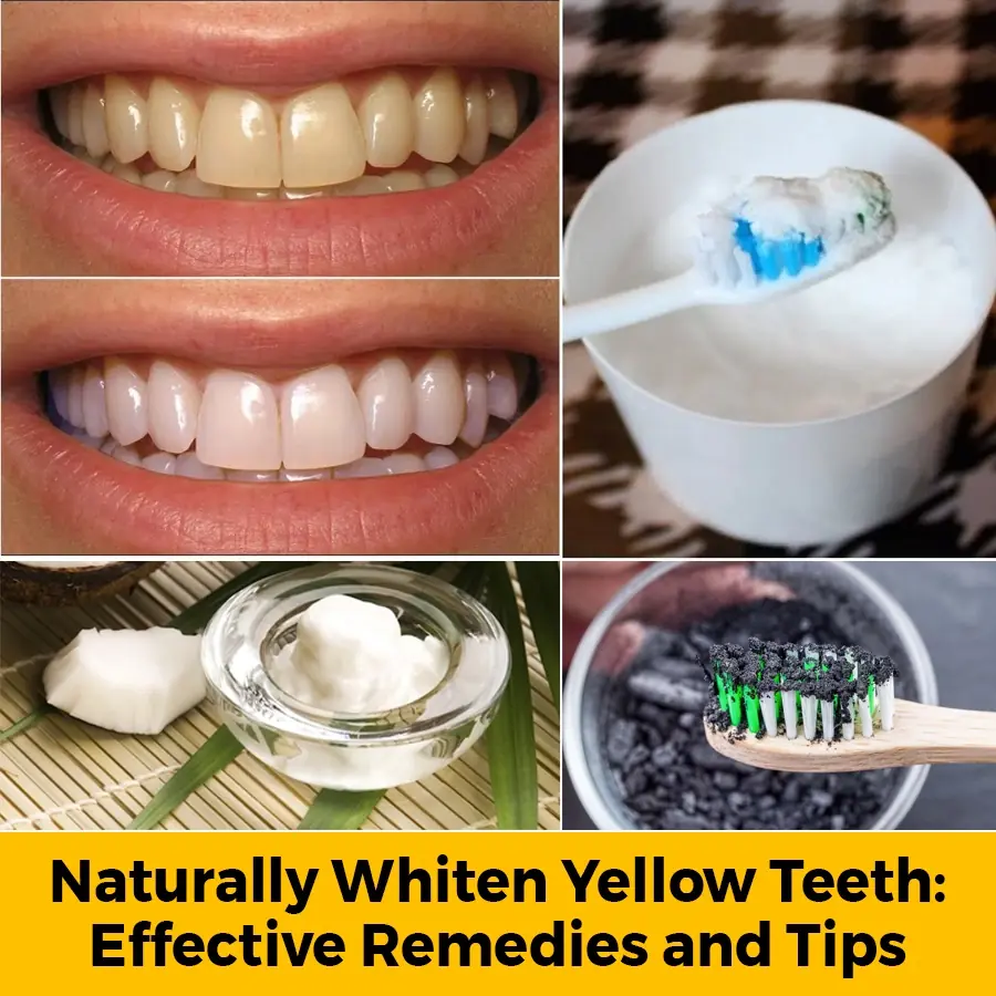 Whiten your smile naturally - cost-free and surprisingly effective methods you won’t want to miss! ⬇️⬇️