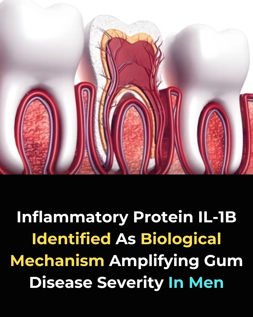 Biological Mechanism Behind Men's Increased Susceptibility to Periodontitis Revealed in New Research