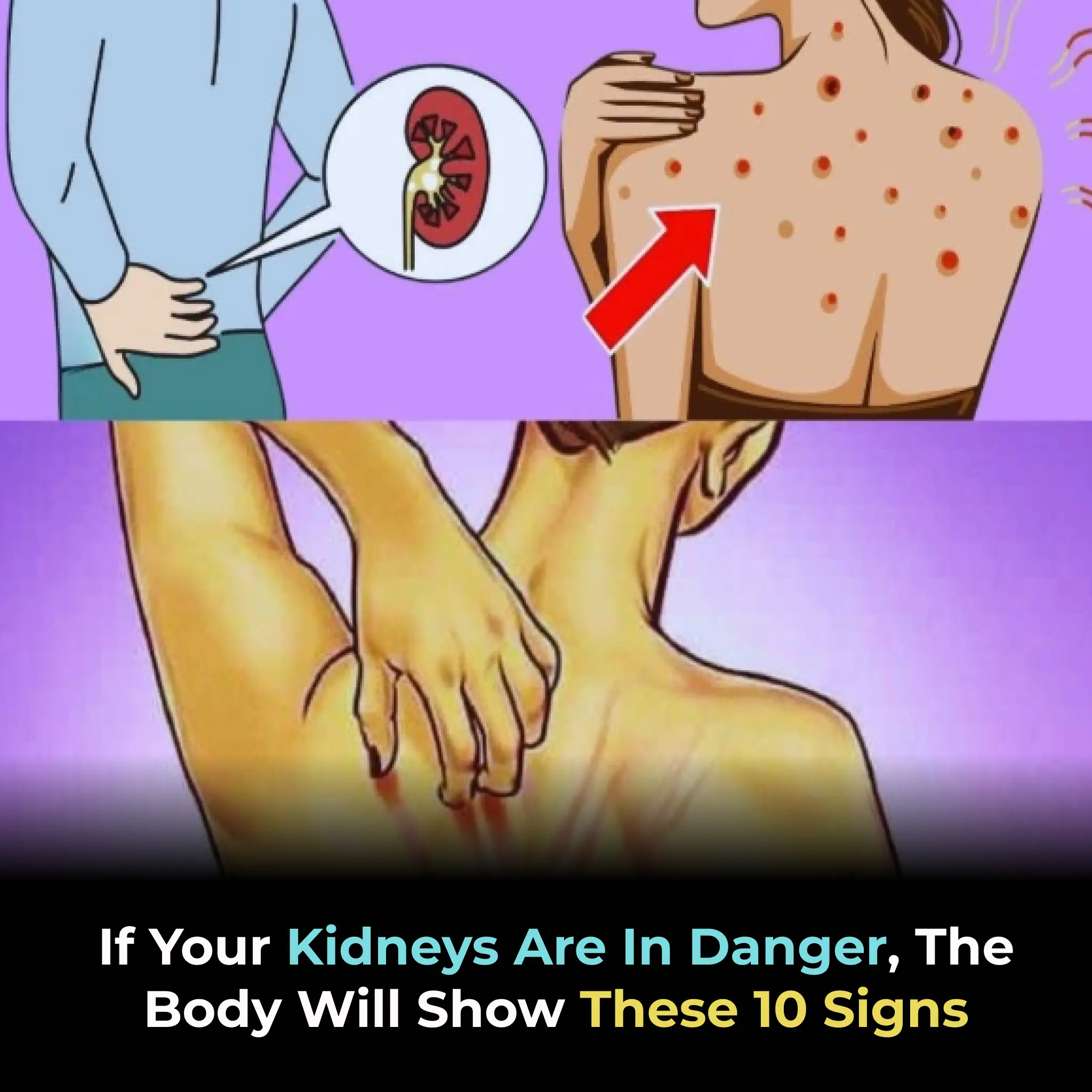 If Your Kidneys Are In Danger, The Body Will Show These 10 Signs