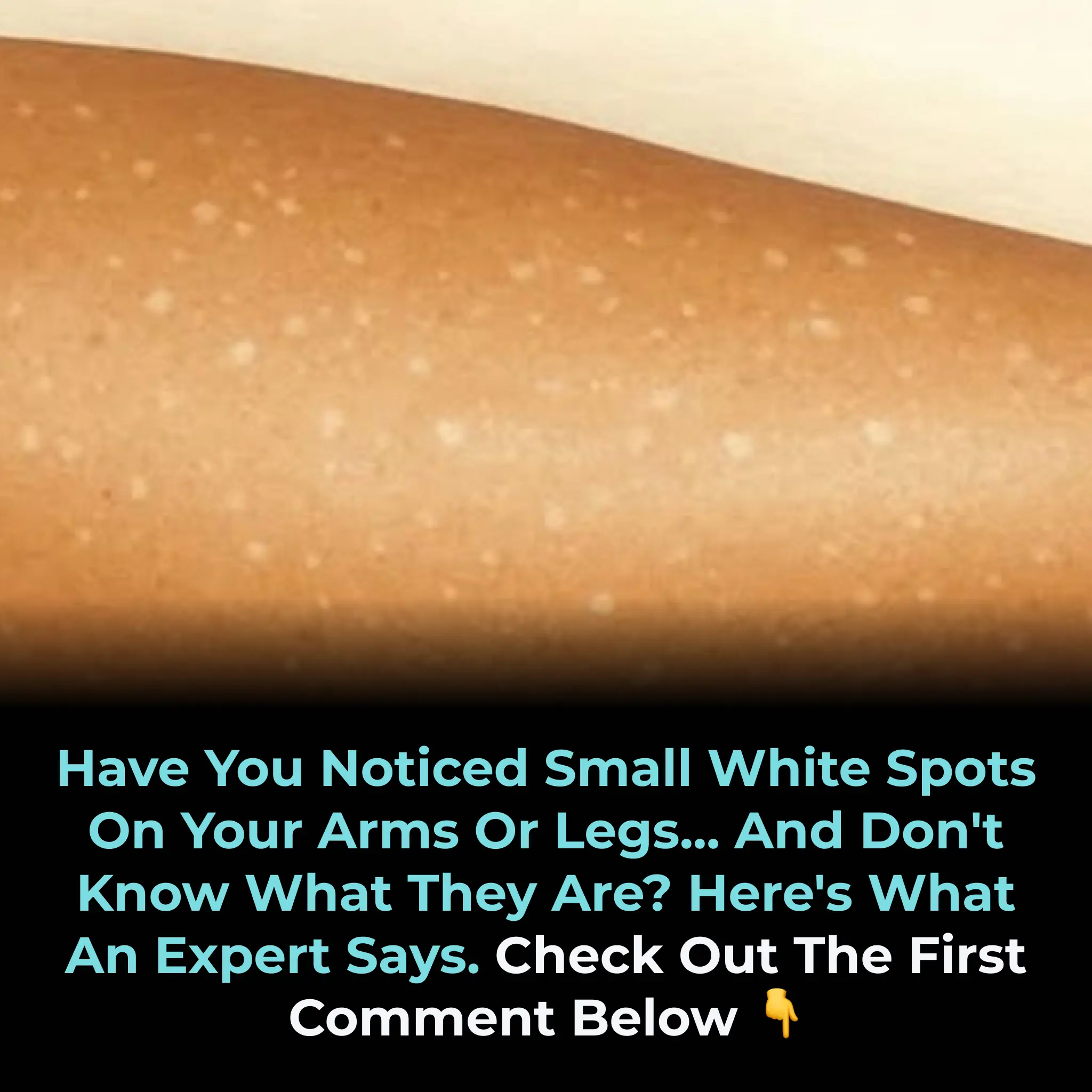 What’s Behind Those White Spots on Your Skin? Possible Causes You Should Know
