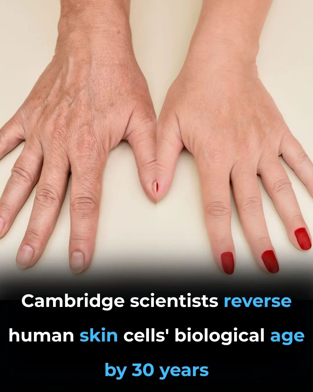 Researchers Restore Youthfulness to Human Skin Cells in Just 13 Days