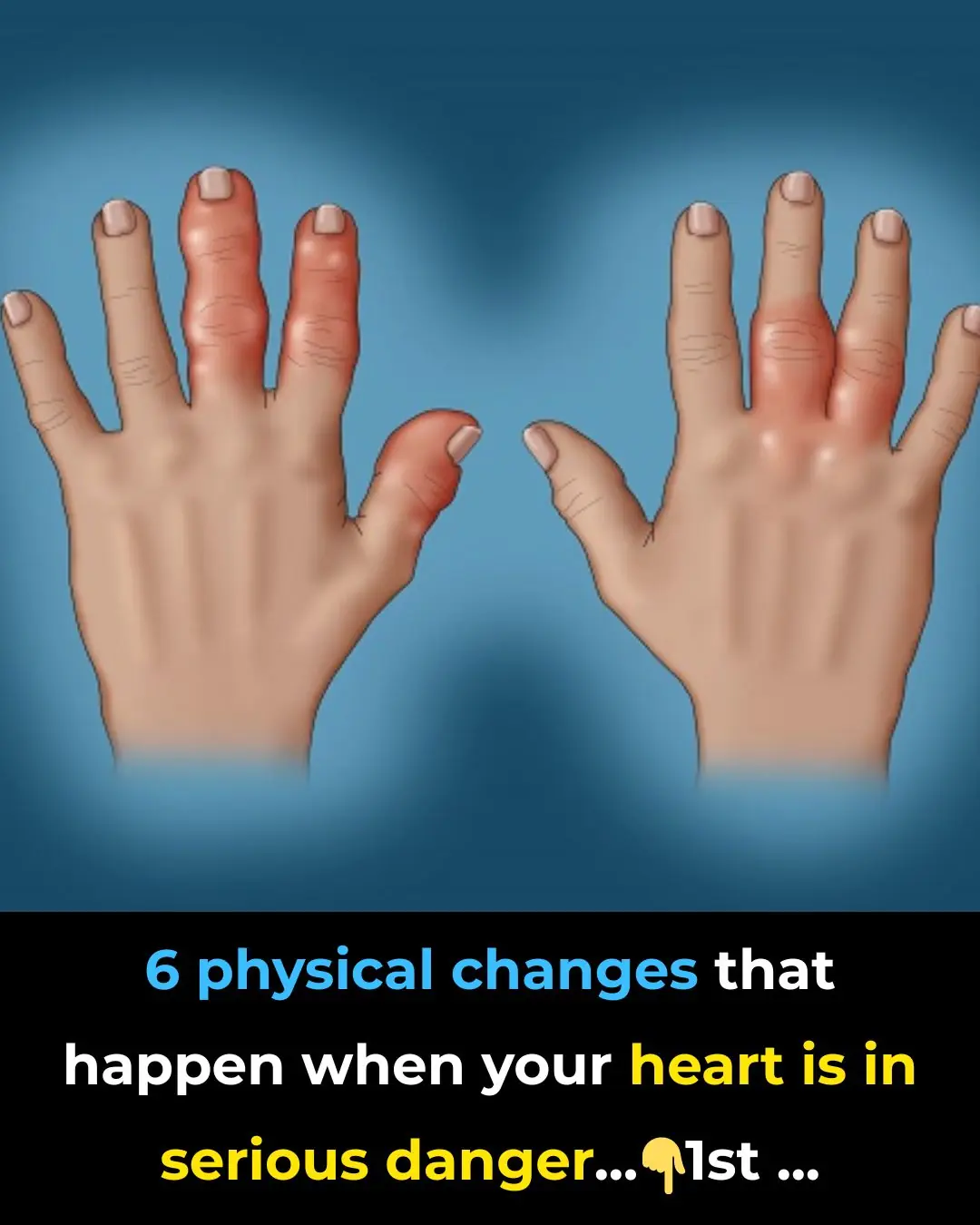 6 Physical Changes That Happen When Your Heart is In Serious Danger