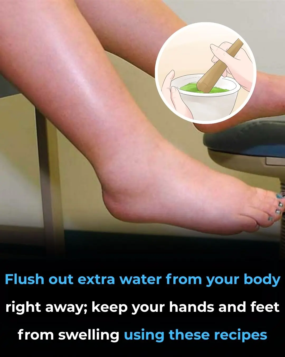 Say Goodbye to Swelling