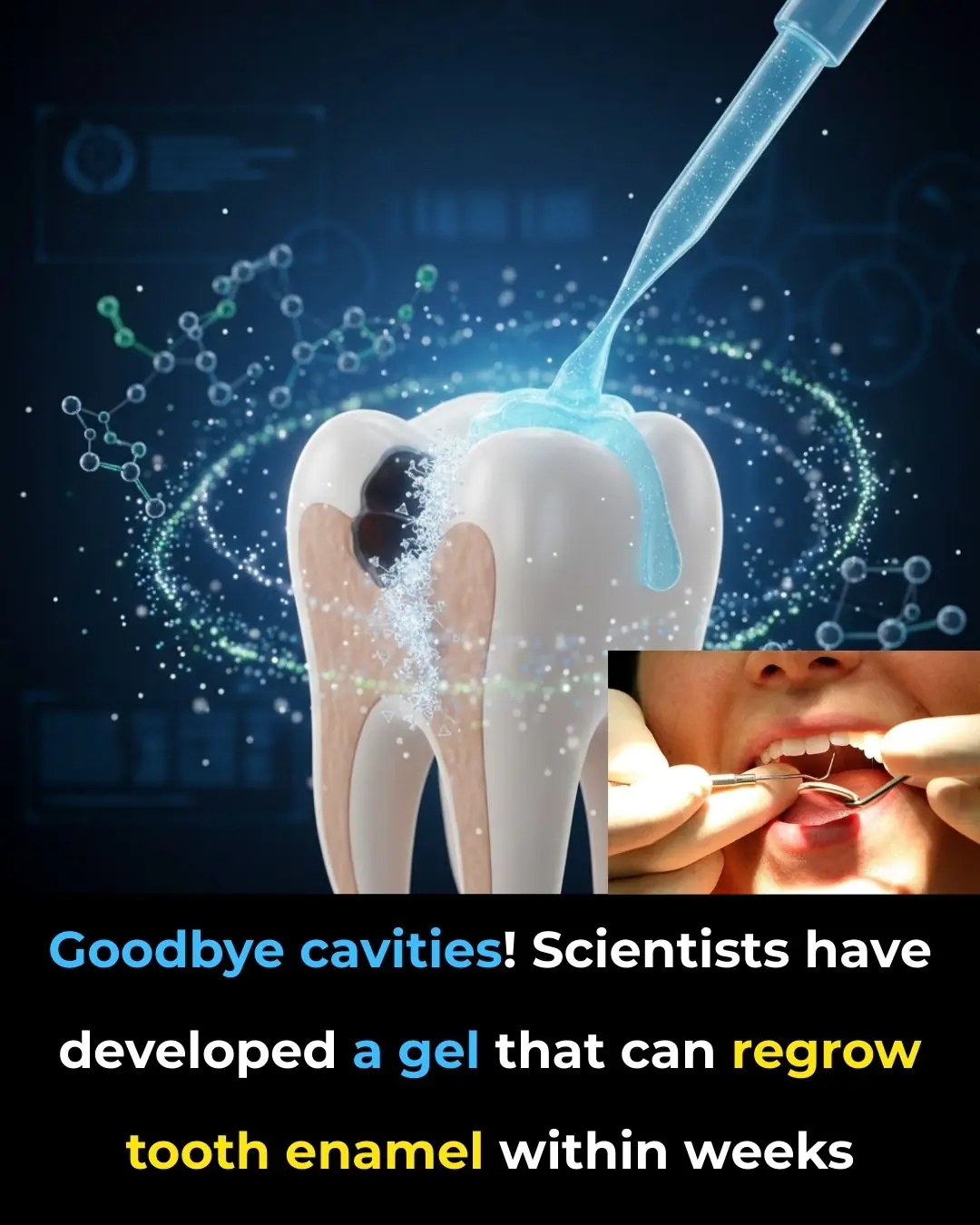 The Gel That Could End Cavities: A New Era of Self-Healing Teeth