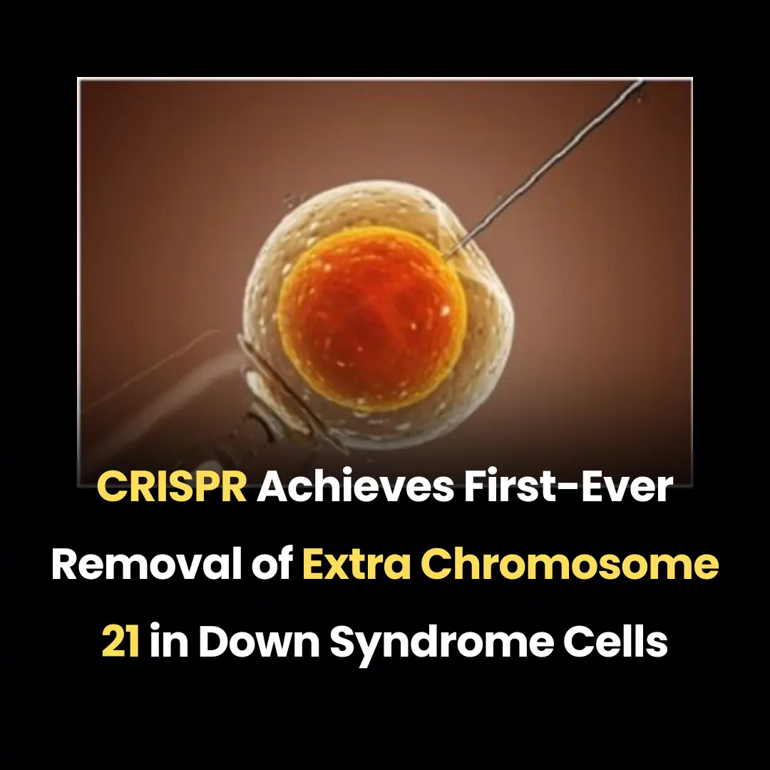 CRISPR Achieves First-Ever Removal of Extra Chromosome 21 in Down Syndrome Cells