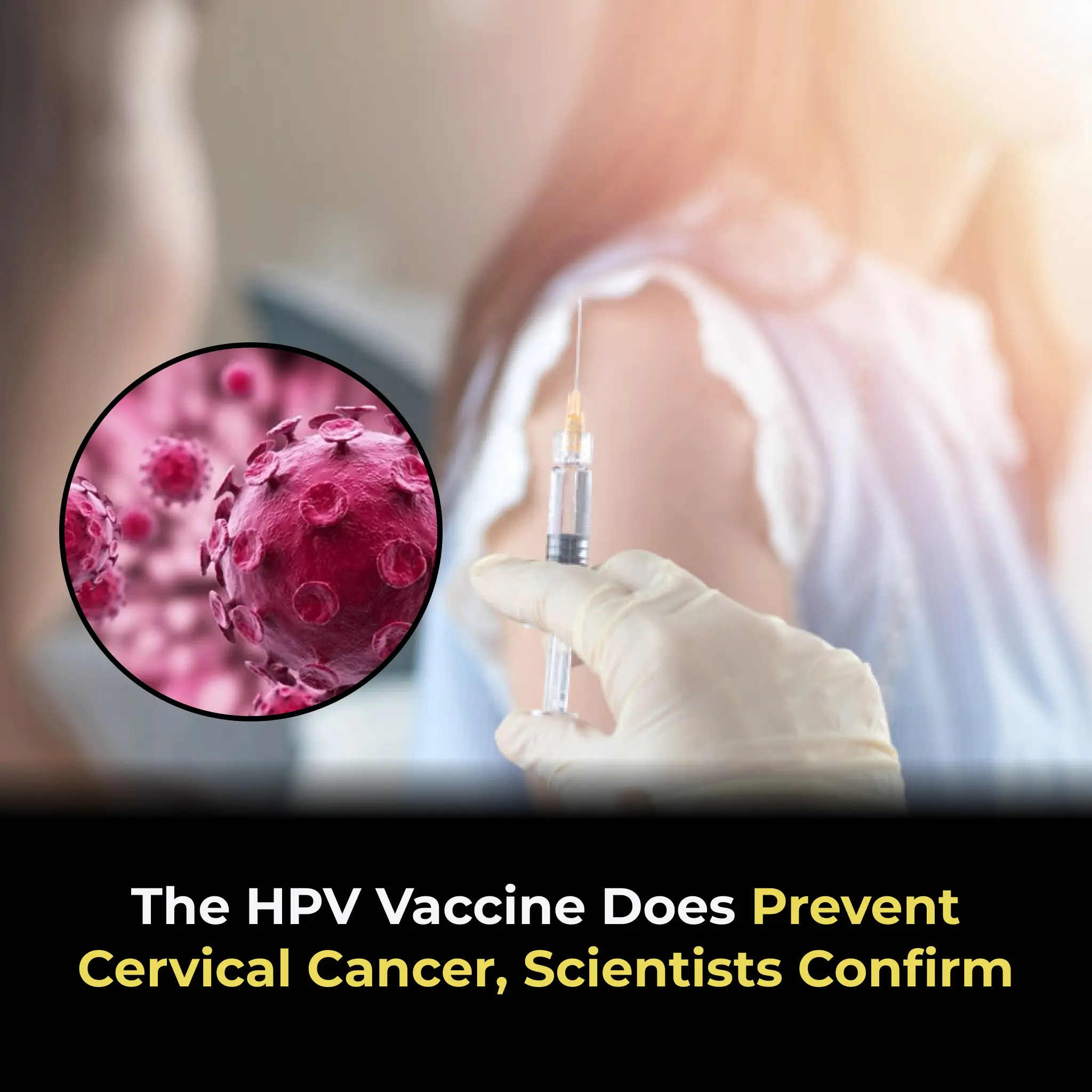 The HPV Vaccine Does Prevent Cervical Cancer, Scientists Confirm