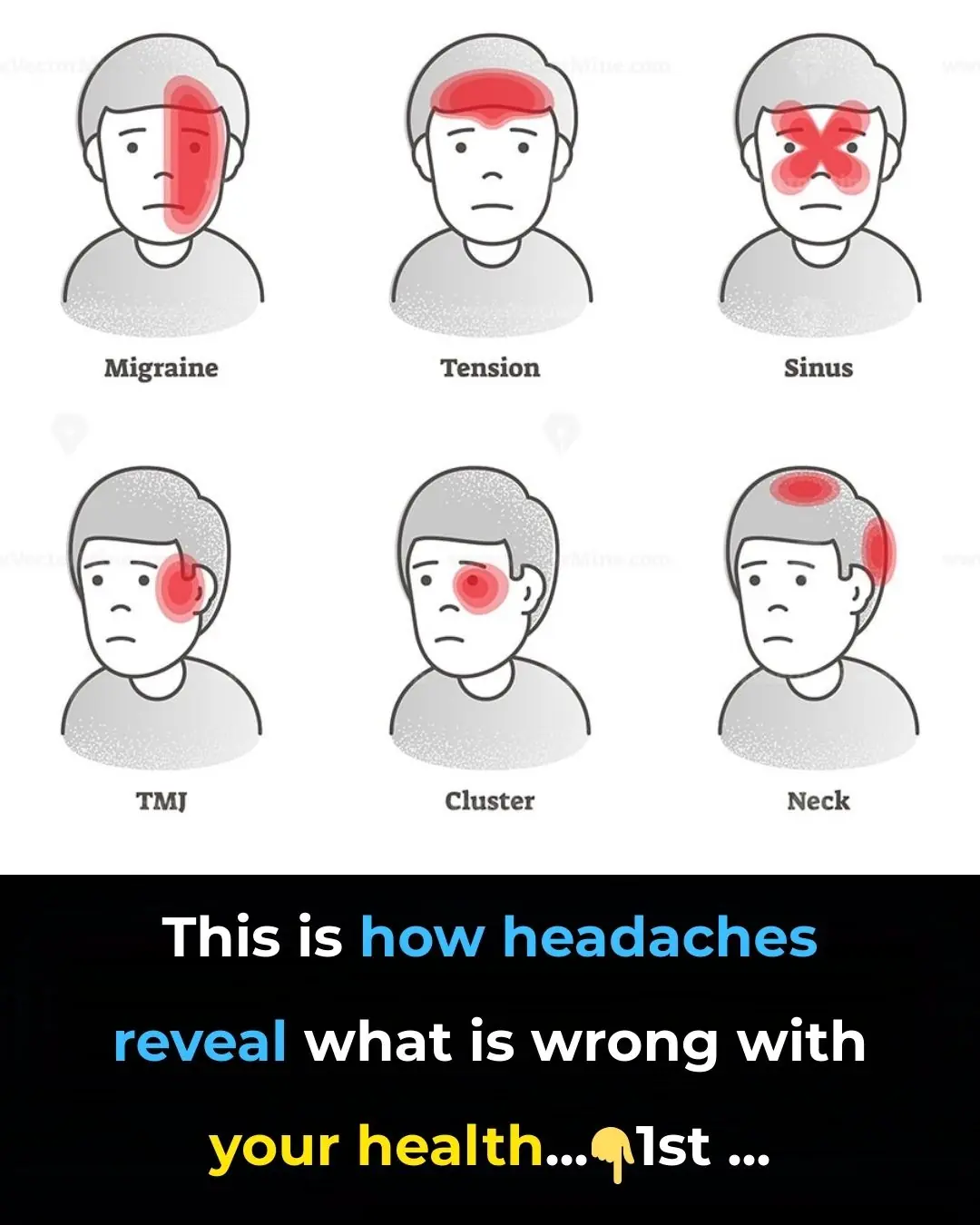 This is How Headaches Reveal What is Wrong With Your Health
