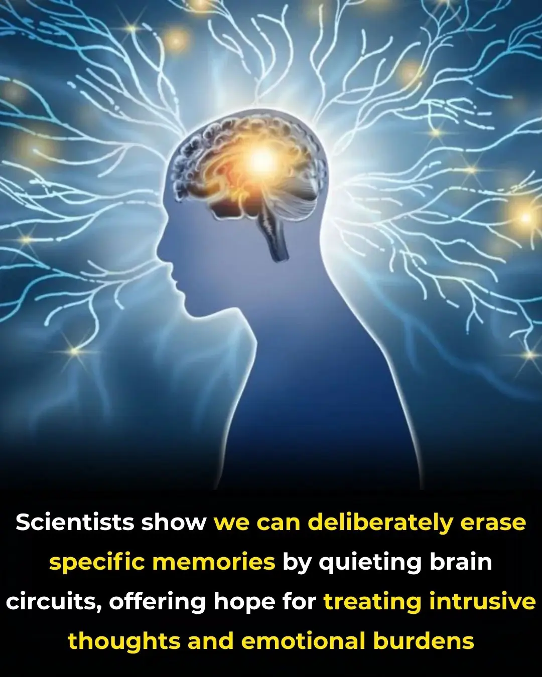 Inside the Science of Forgetting: How the Brain Downregulates Unwanted Memories