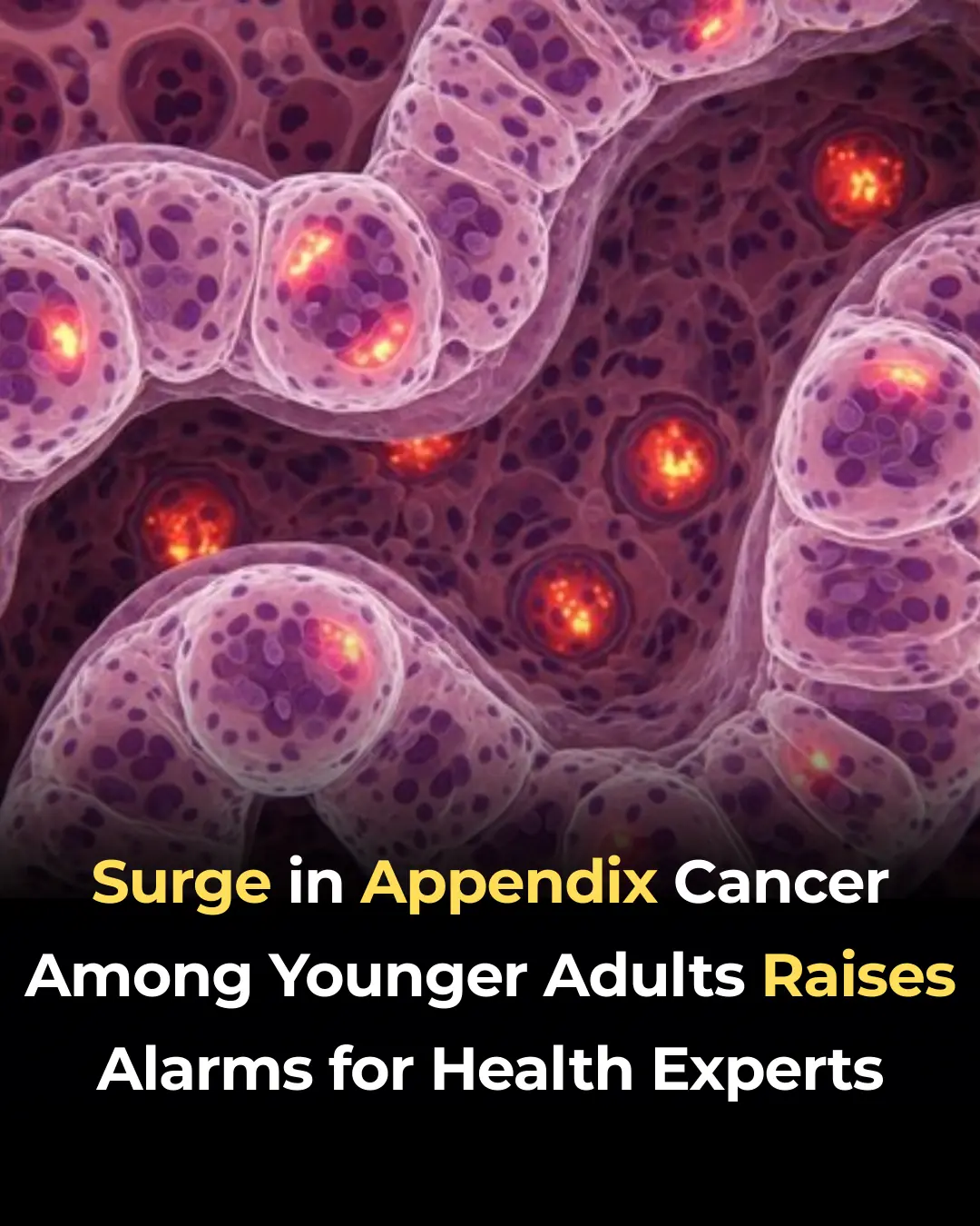 Surge in Appendix Cancer Among Younger Adults Raises Alarms for Health Experts