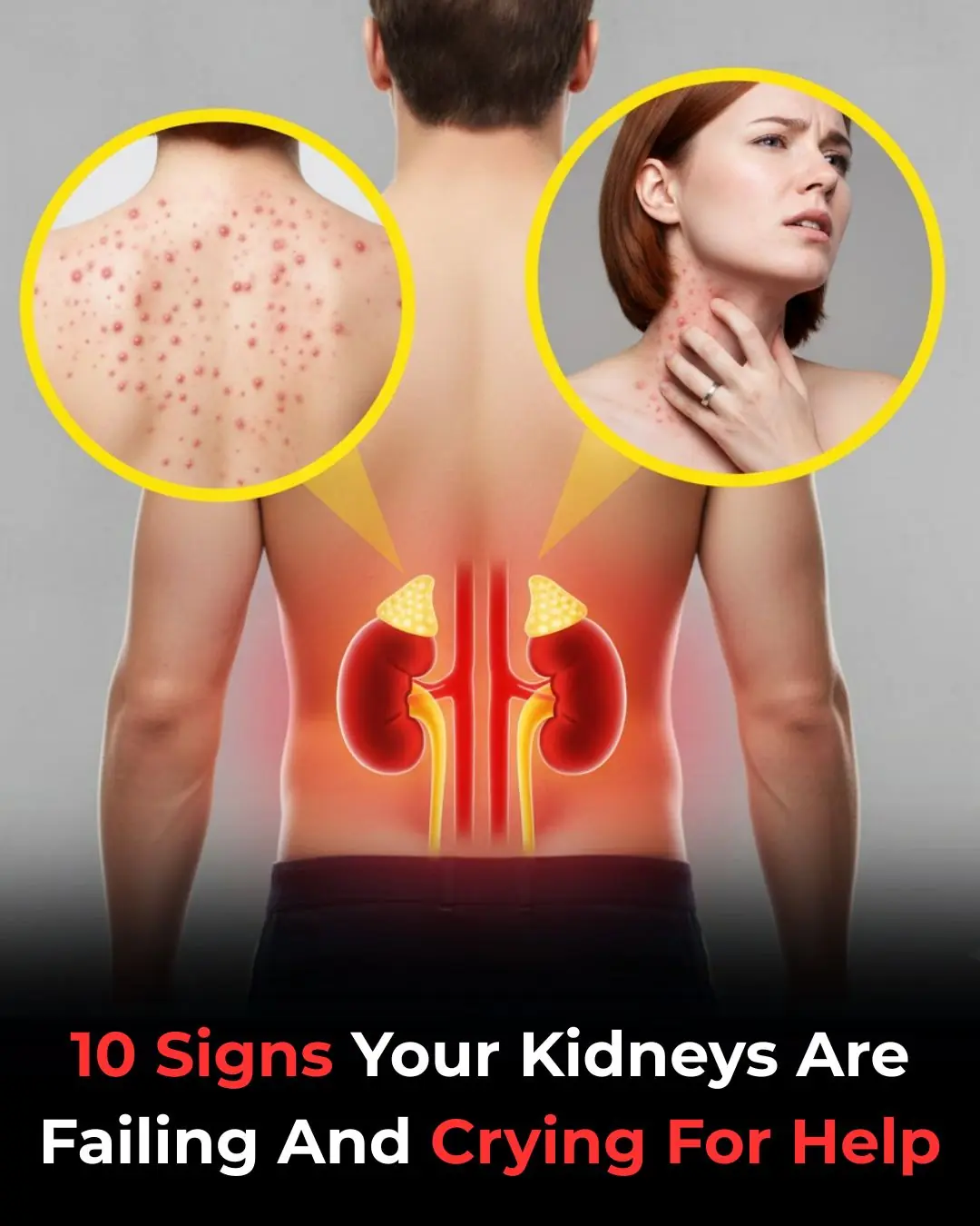 Signs of kidney failure that if ignored may require lifelong dialysis!