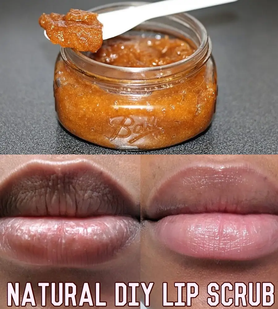 Dark Lips? 8 Natural Remedies to Lighten and Brighten Your Pout Fast!