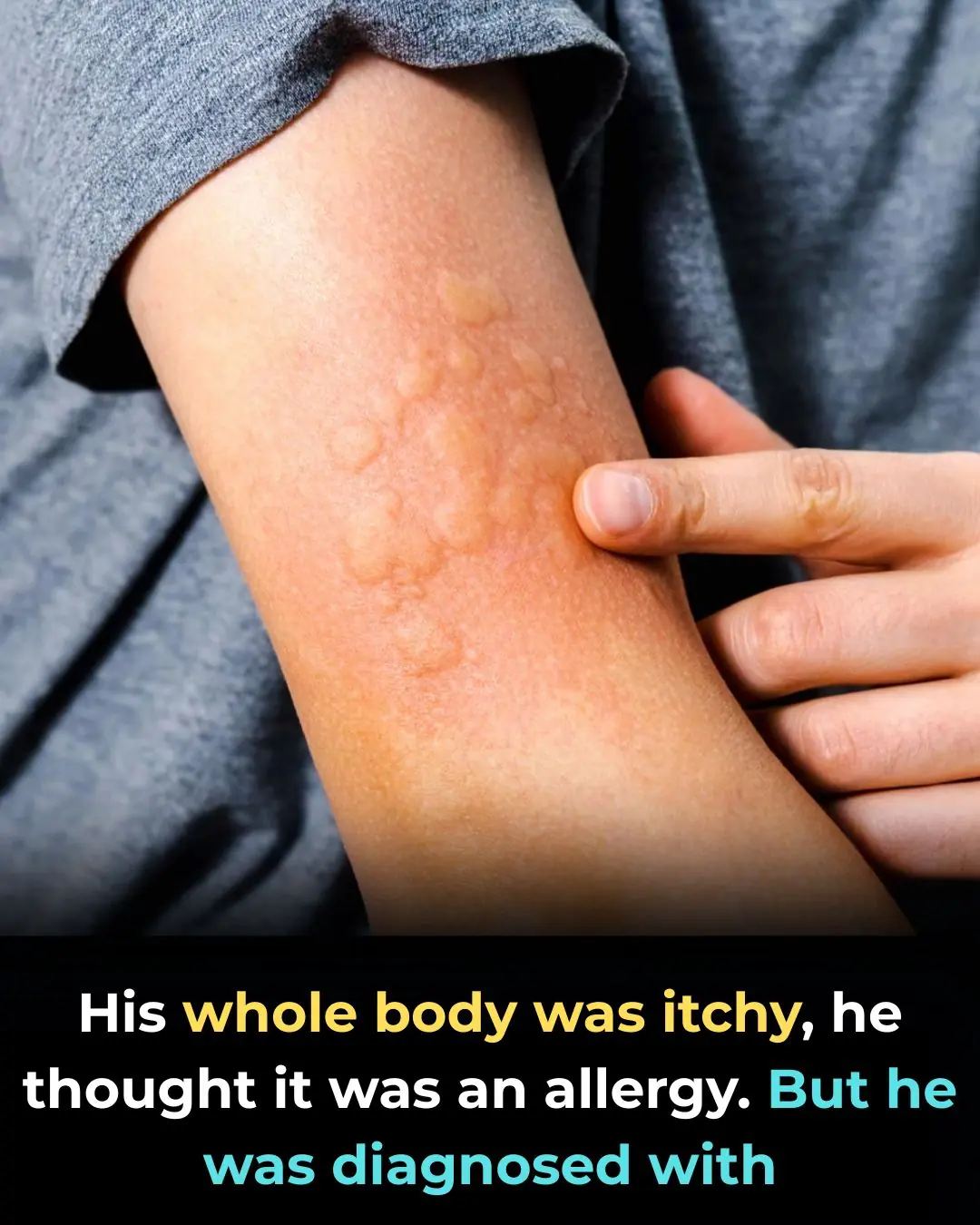 He thought it was just an allergy, until the diagnosis proved otherwise