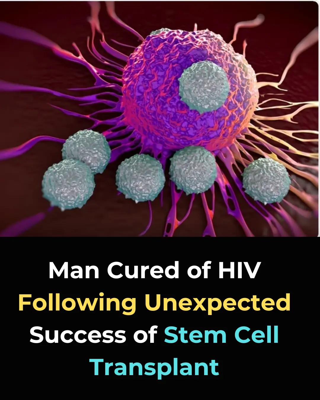 Breakthrough in HIV Cure: Stem Cell Transplant Leads to HIV Remission Without CCR5-Δ32 Mutation