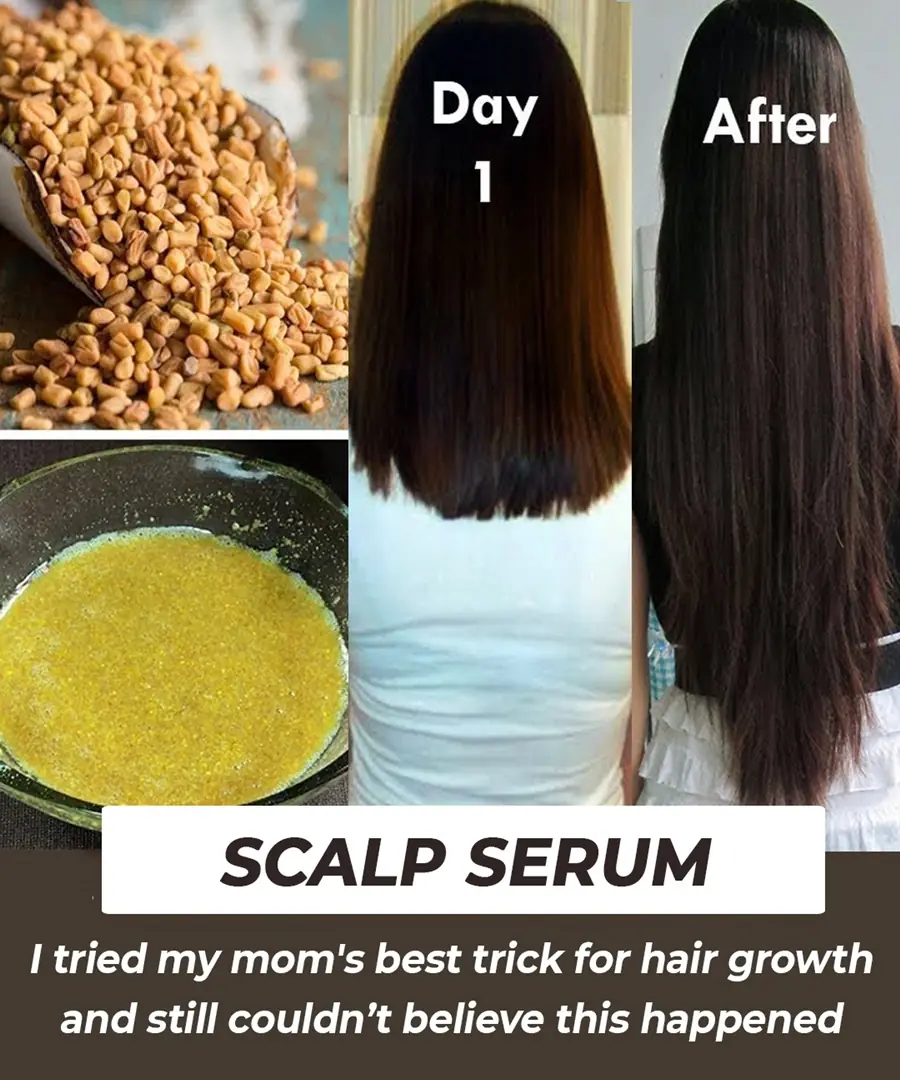Hair Spray to Regrow Lost Hair