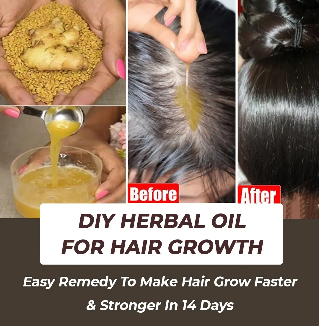 DIY Ginger Herbal Oil for Faster Hair Growth: A Natural Remedy for Strong, Healthy Hair