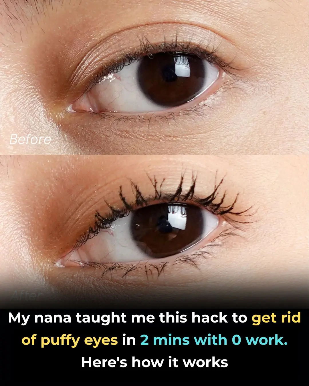 The 2-Minute Potato Trick My Nana Swore By for Puffy Eyes